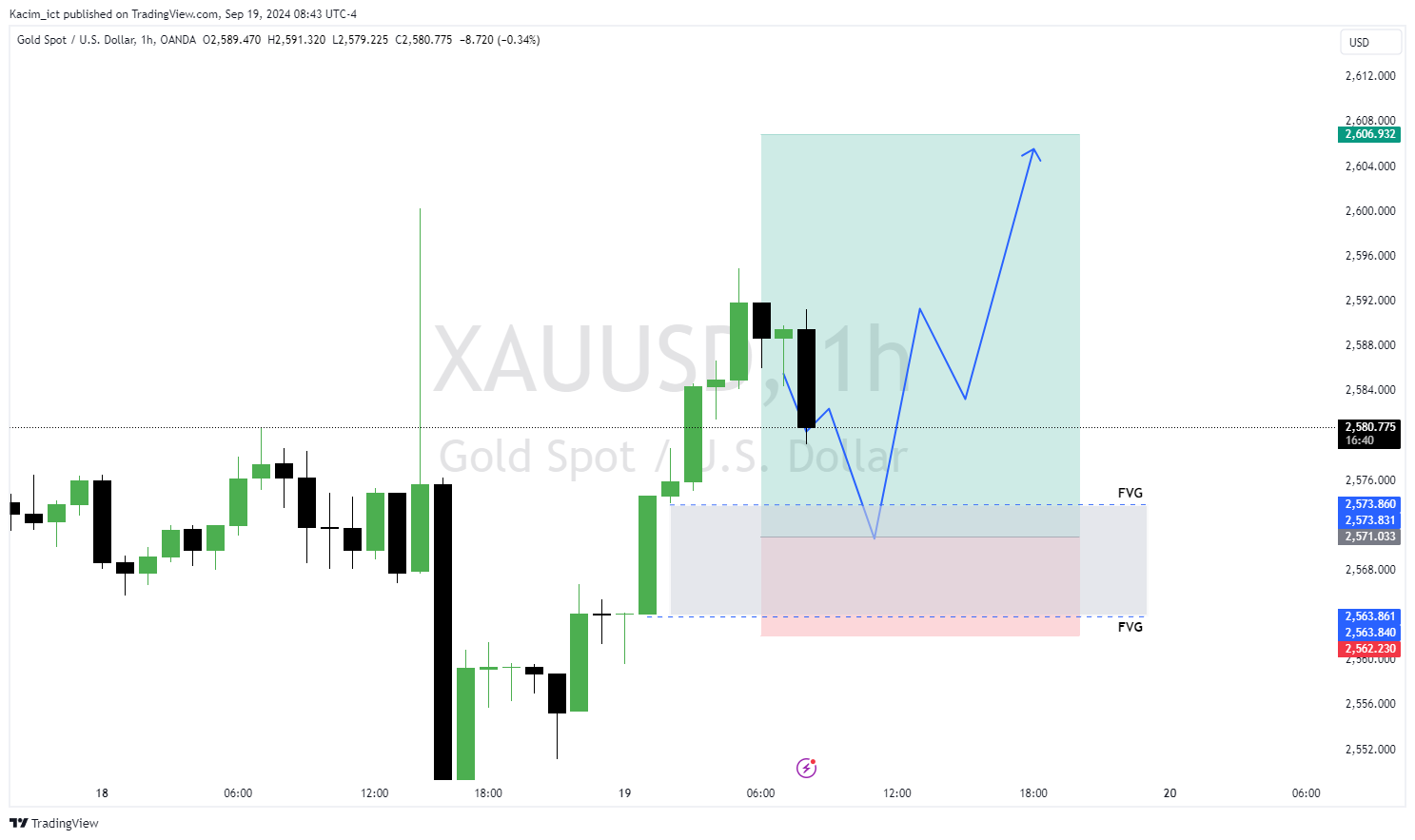 OANDA:XAUUSD Chart Image by Kacim_ict