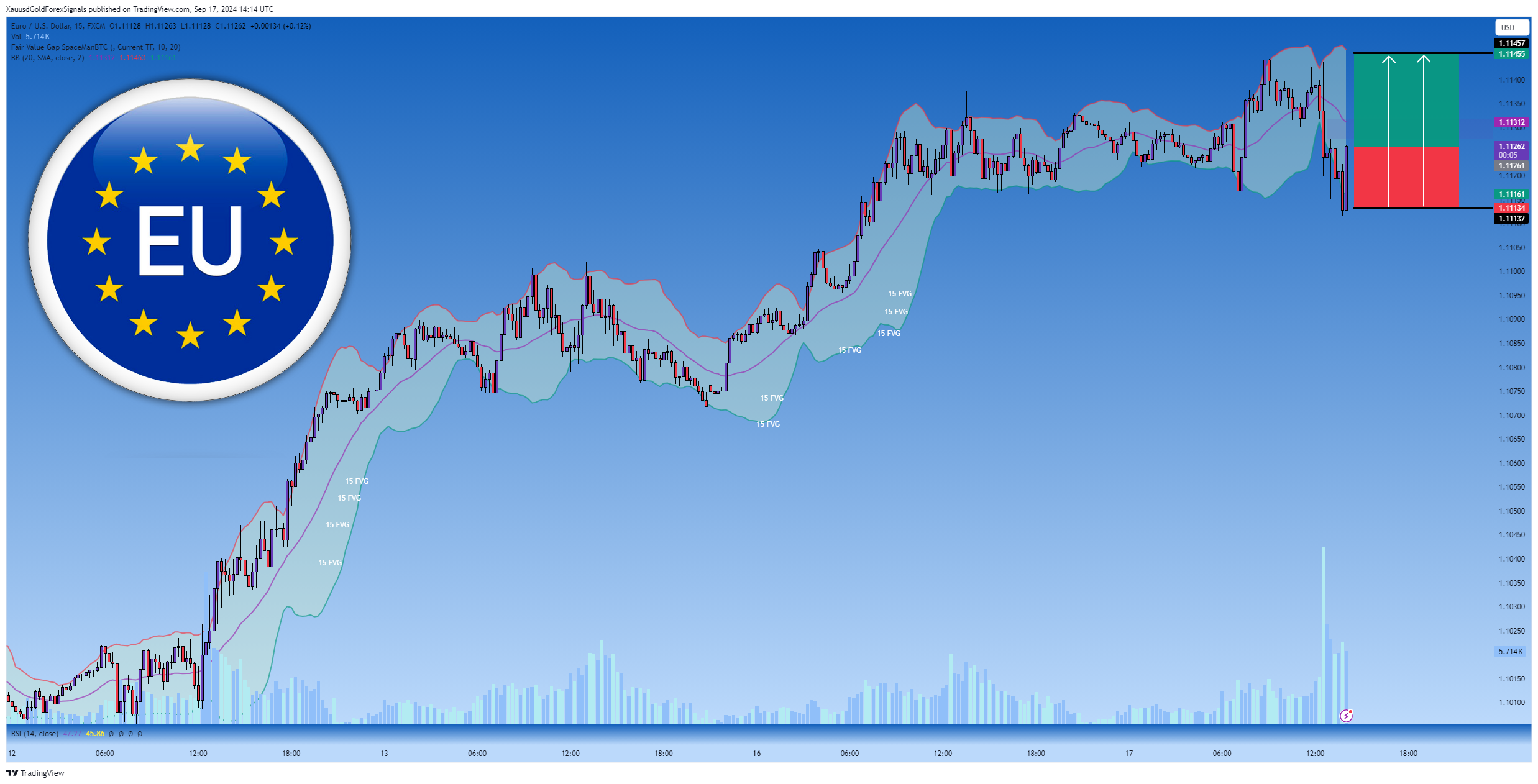 FX:EURUSD Chart Image by XauusdGoldForexSignals
