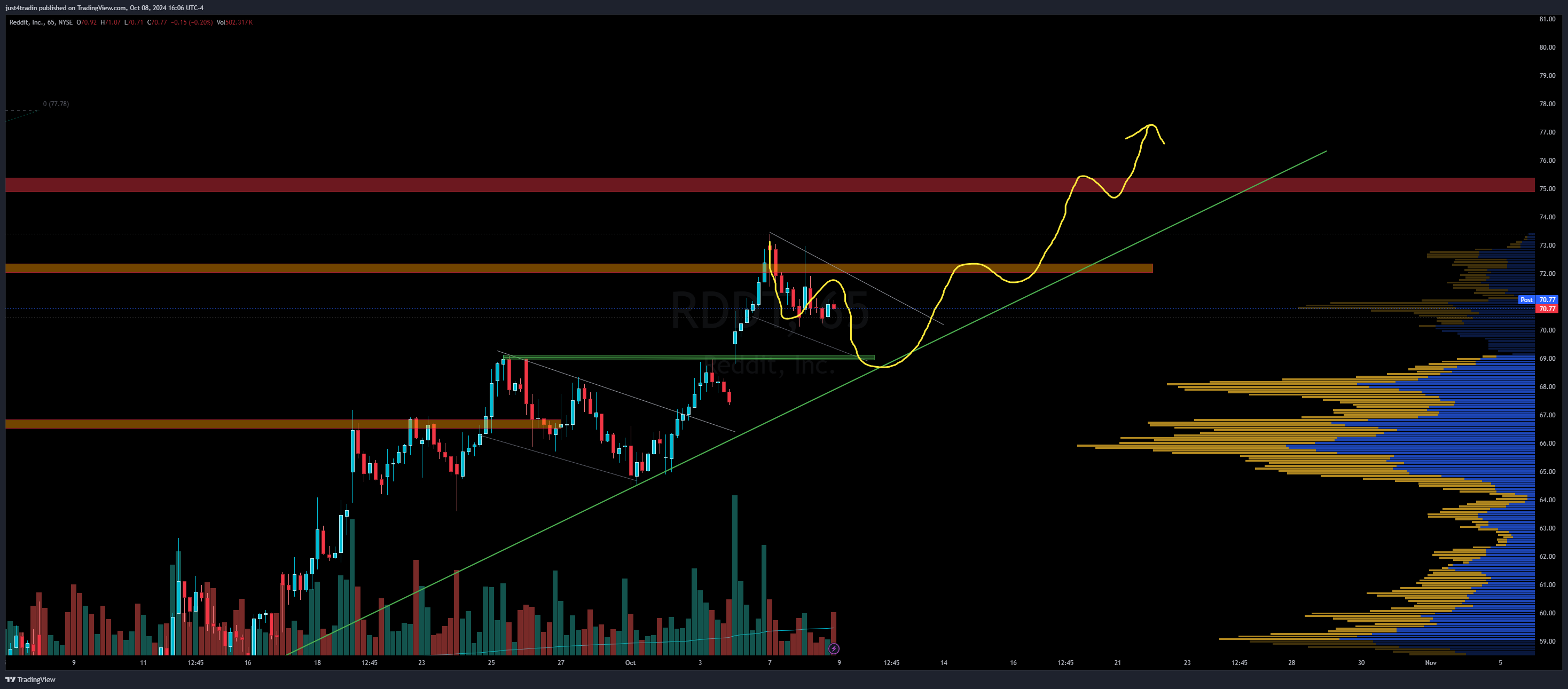 NYSE:RDDT Chart Image by just4tradin