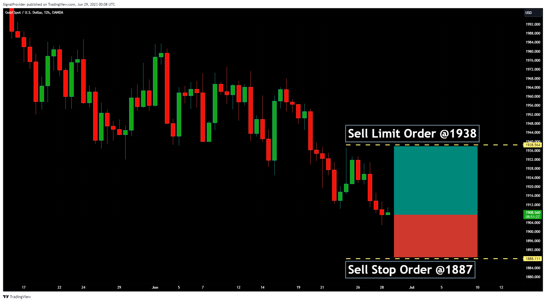 OANDA:XAUUSD Chart Image by SignalProvider