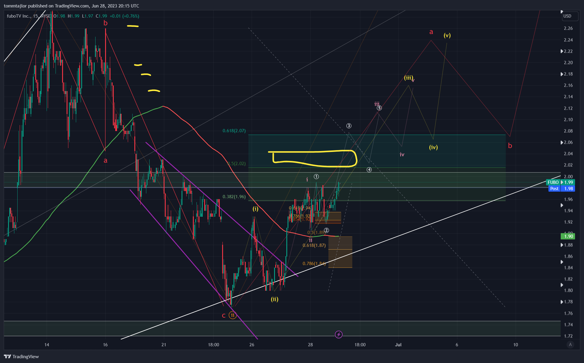 NYSE:FUBO Chart Image by tommtajlor