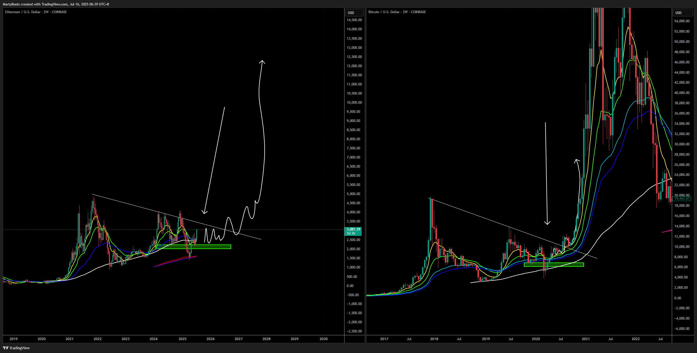 COINBASE:ETHUSD Chart Image by MartyBoots