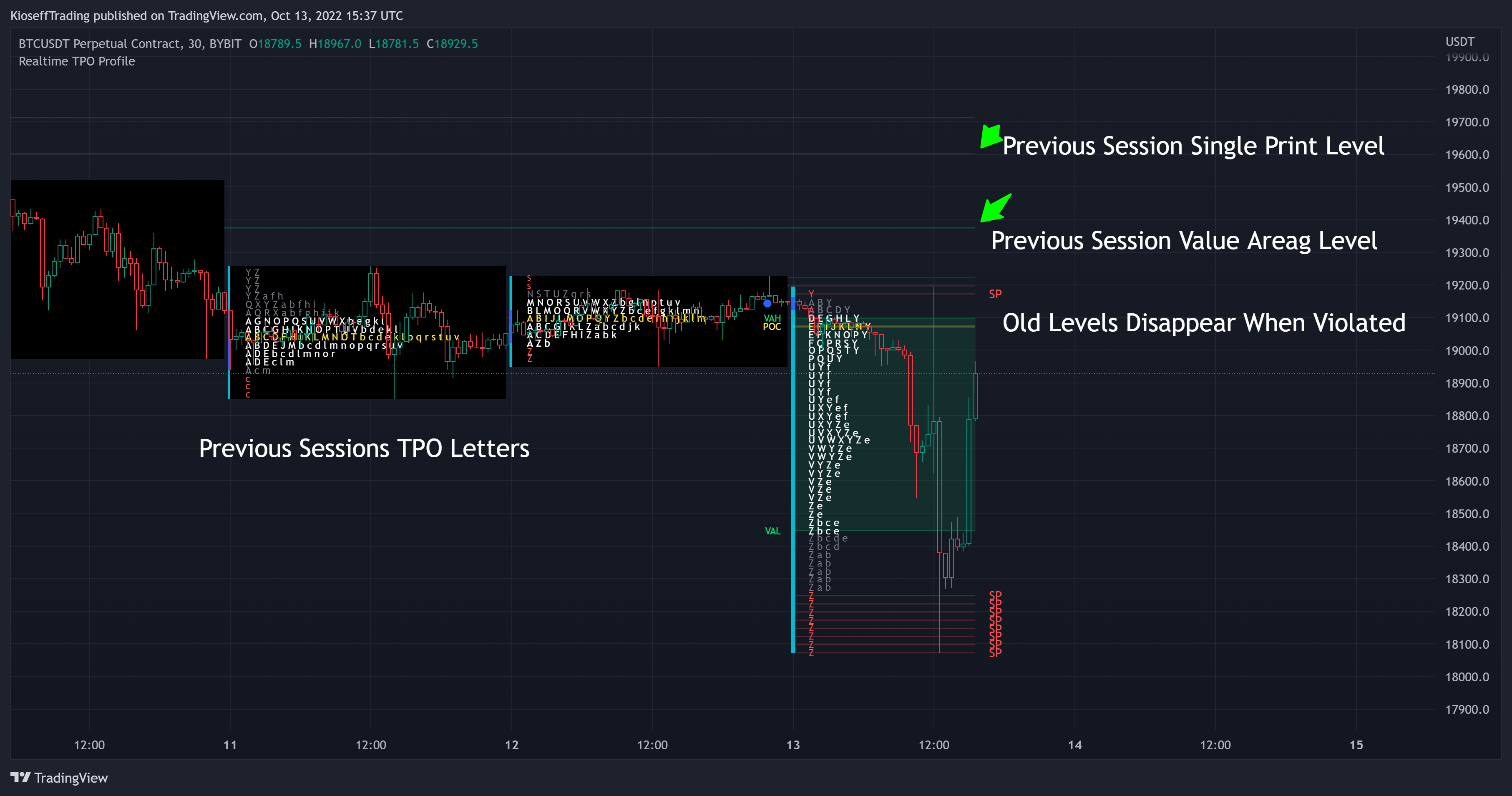 BYBIT:BTCUSDT Chart Image by KioseffTrading