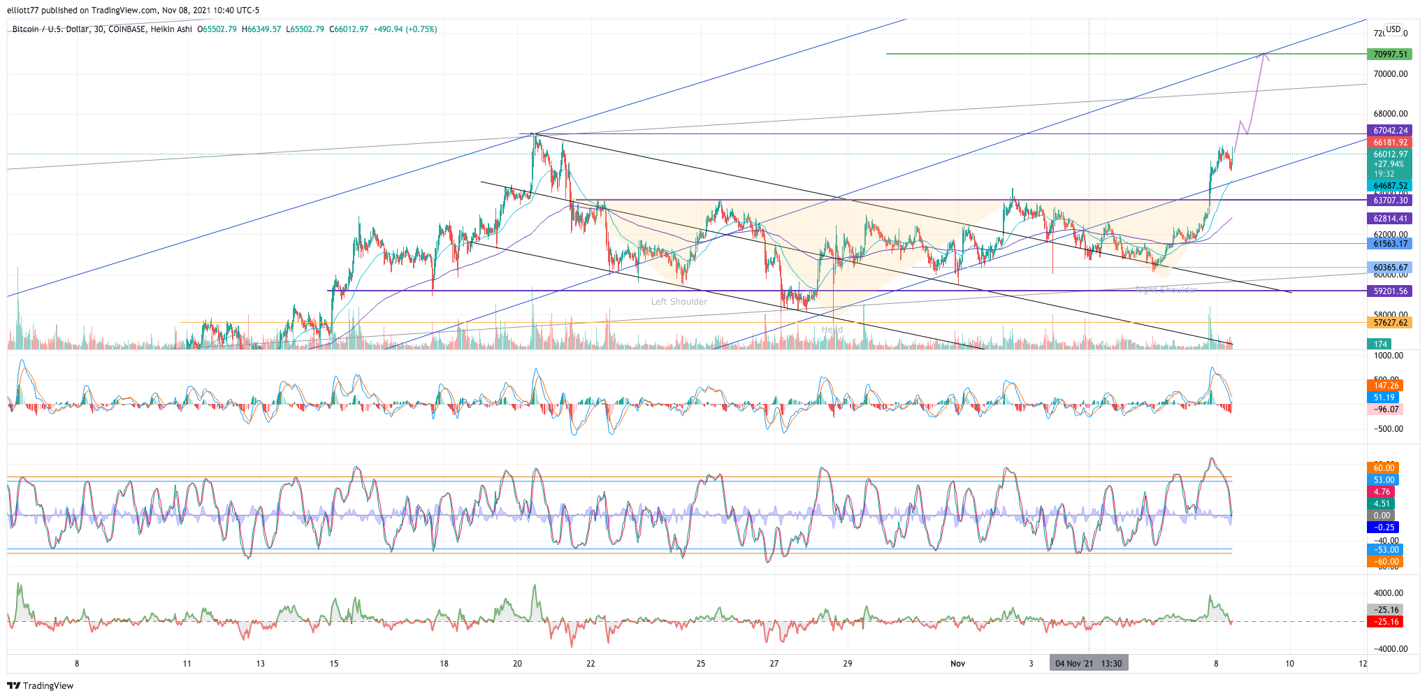 COINBASE:BTCUSD Chart Image by elliott77