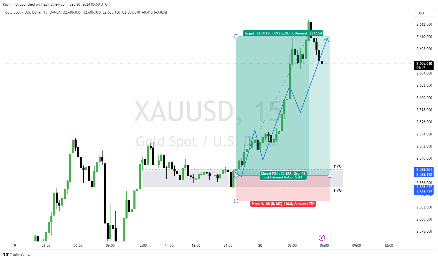 OANDA:XAUUSD Chart Image by Kacim_ict