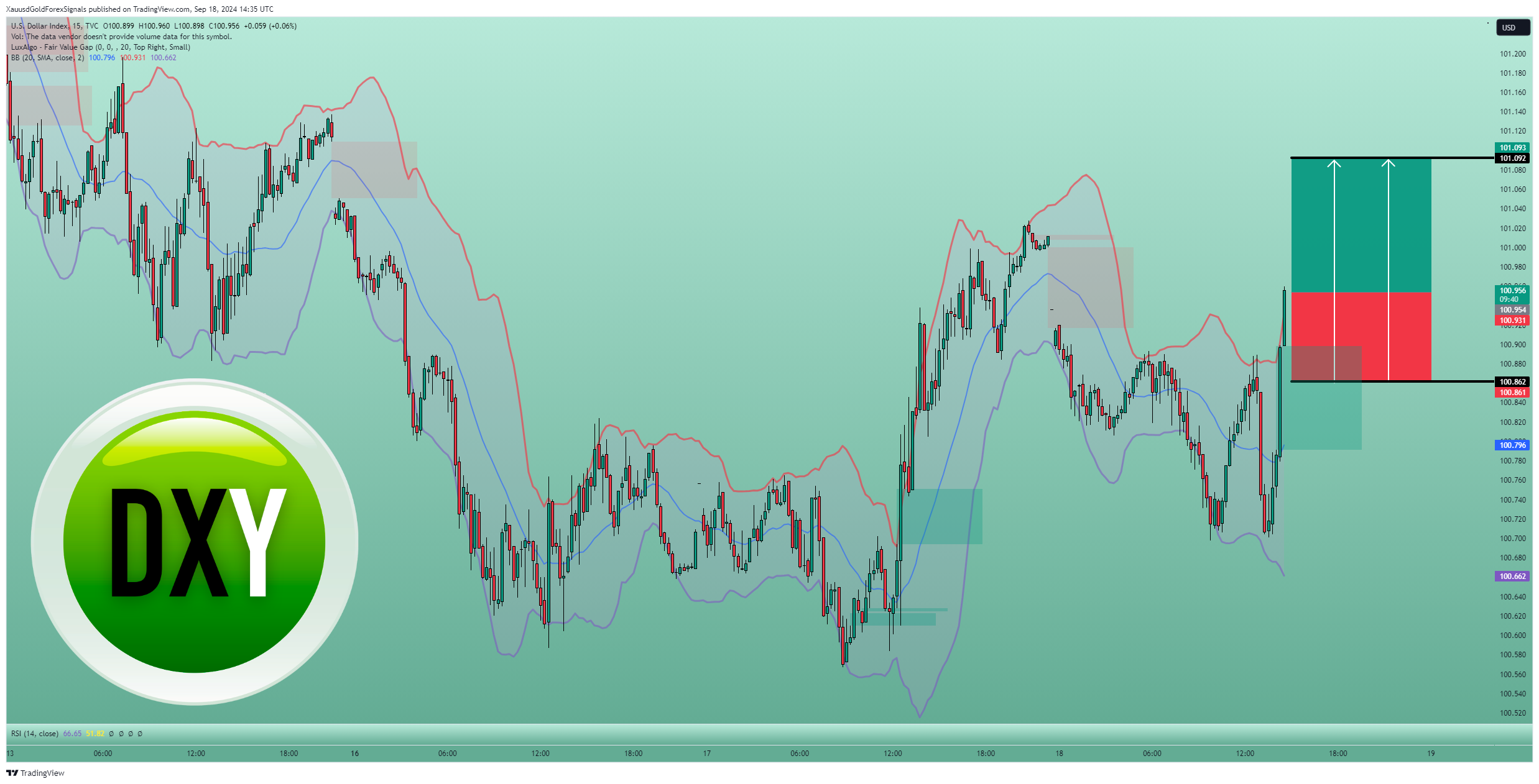 TVC:DXY Chart Image by XauusdGoldForexSignals