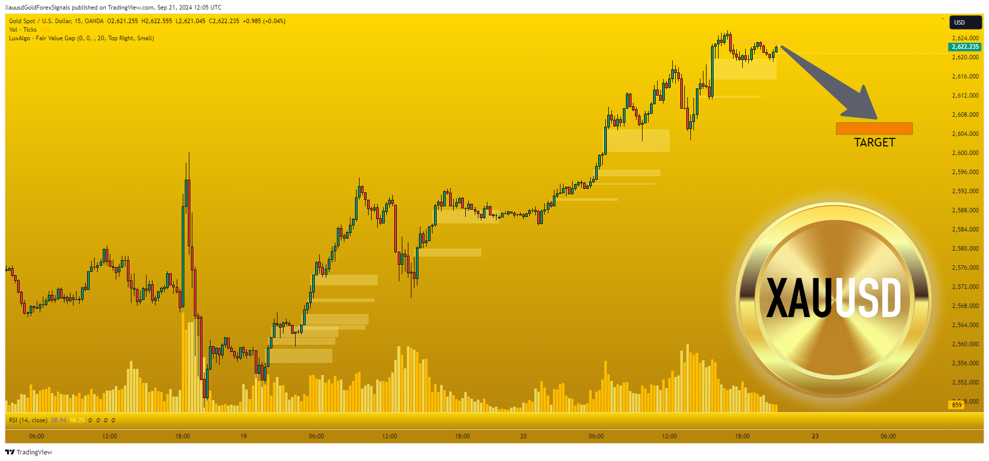 OANDA:XAUUSD Chart Image by XauusdGoldForexSignals