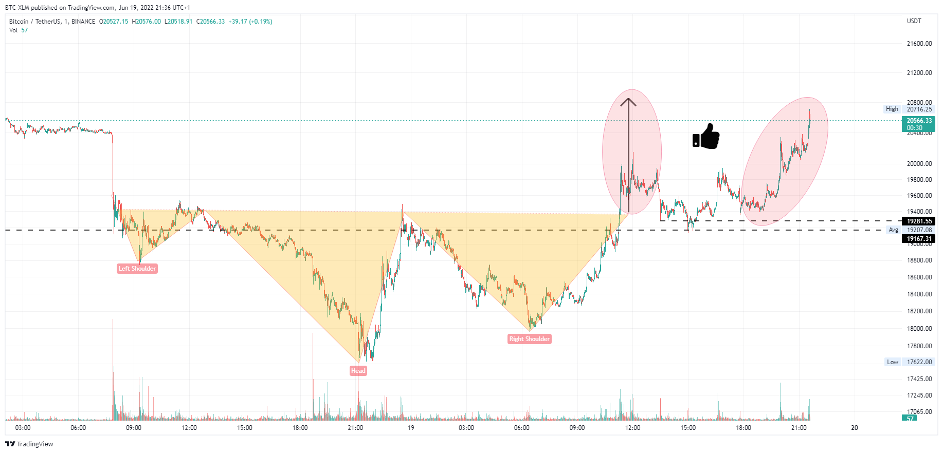 BINANCE:BTCUSDT Chart Image by BTC-XLM