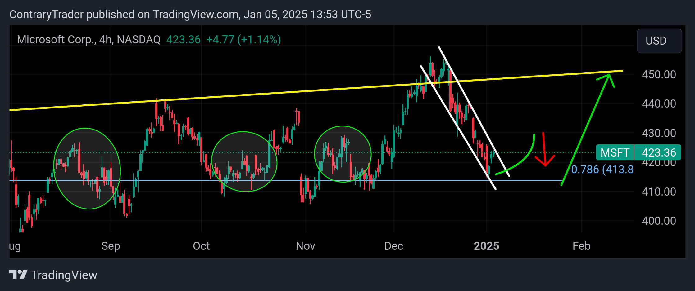 BATS:MSFT Chart Image by ContraryTrader