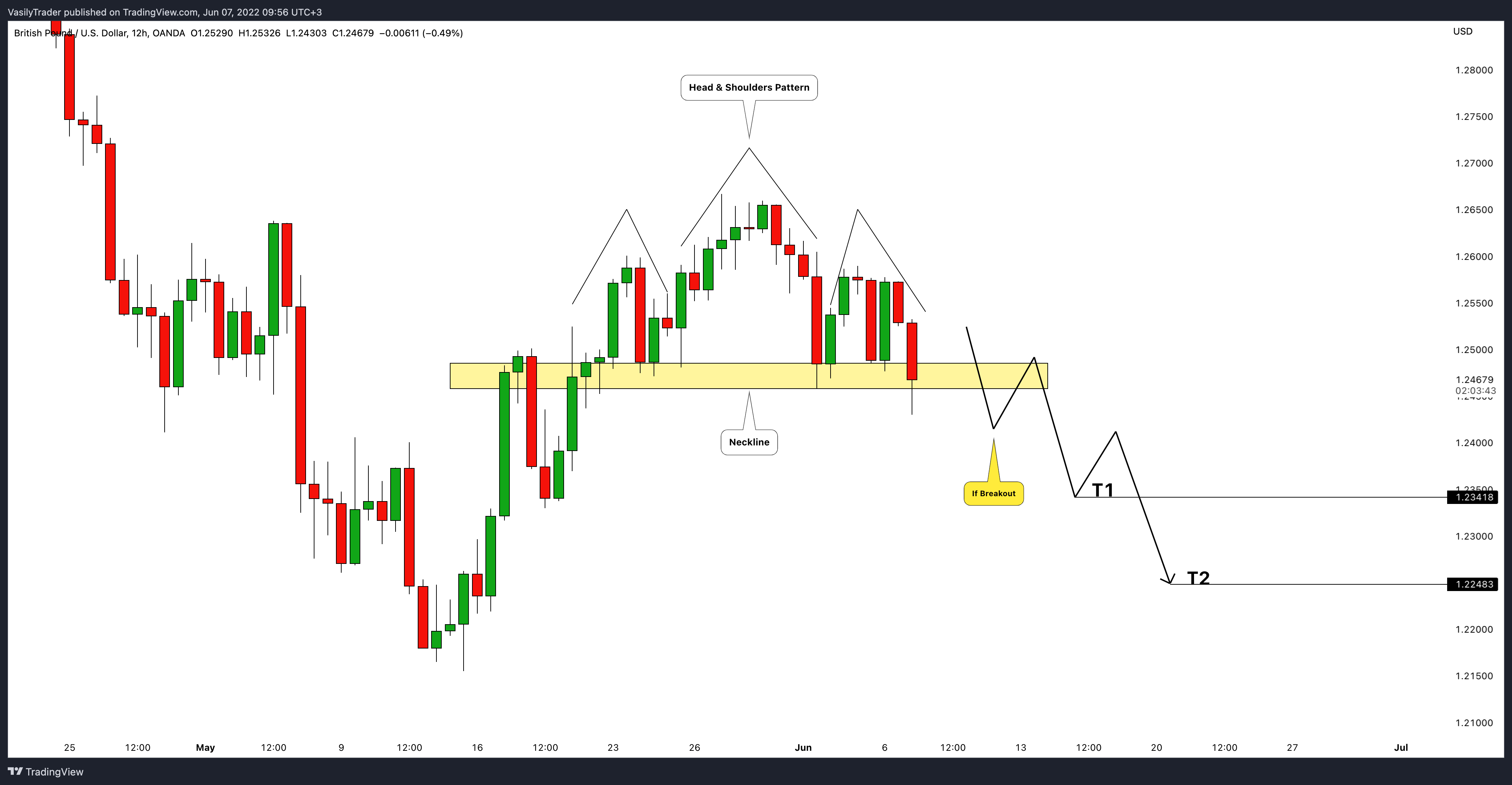 OANDA:GBPUSD Chart Image by VasilyTrader