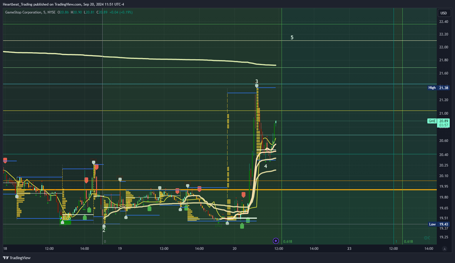 BATS:GME Chart Image by Heartbeat_Trading