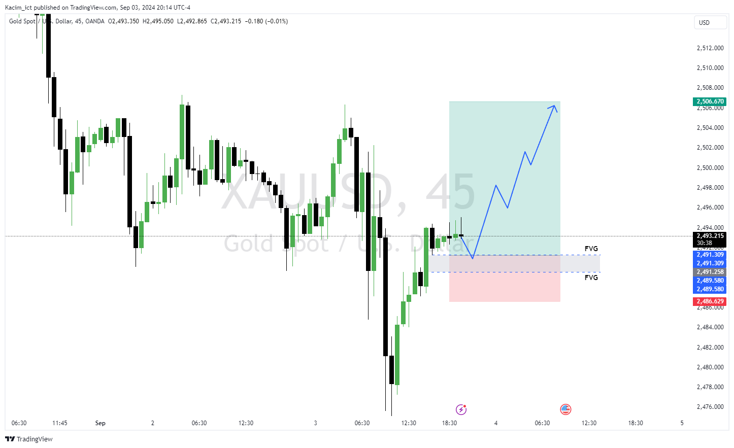 OANDA:XAUUSD Chart Image by Kacim_ict