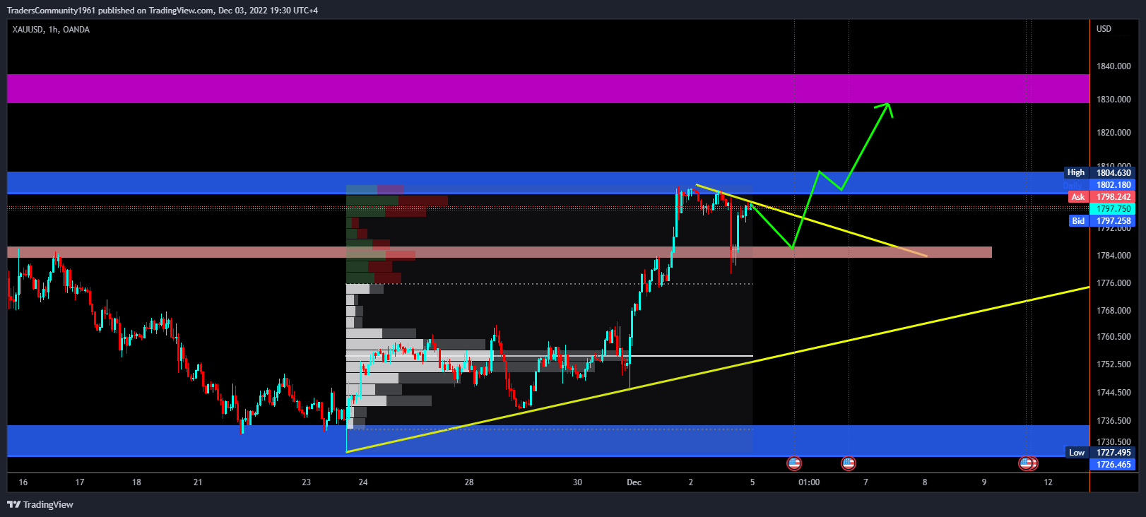 OANDA:XAUUSD Chart Image by TradersCommunity1961