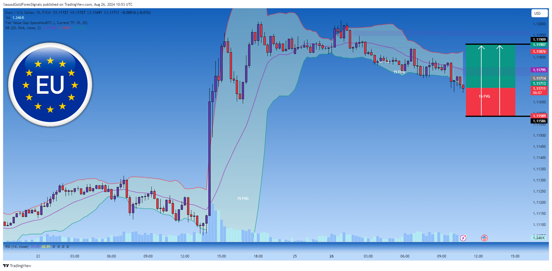 FX:EURUSD Chart Image by XauusdGoldForexSignals