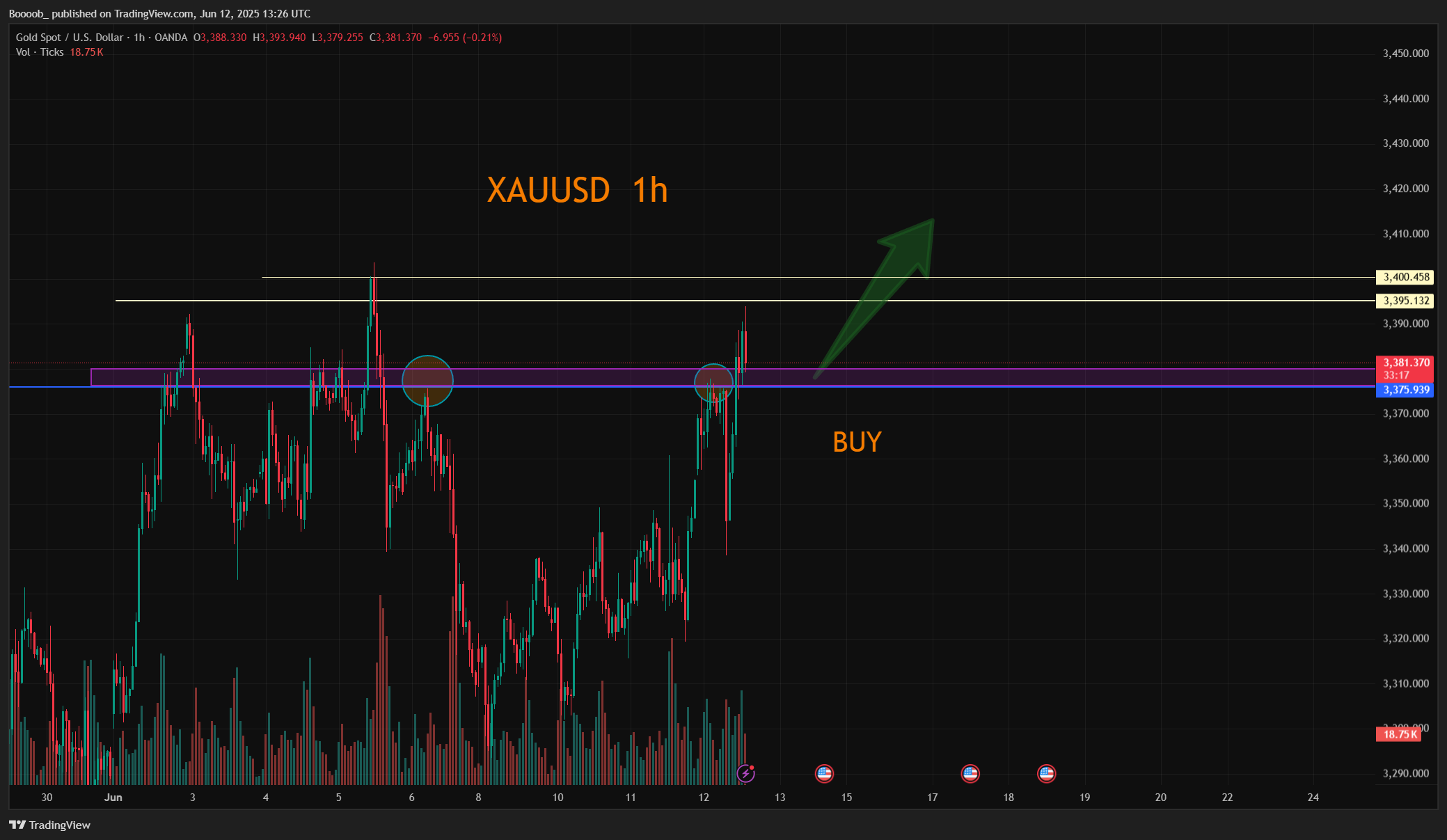 OANDA:XAUUSD Chart Image by Boooob_