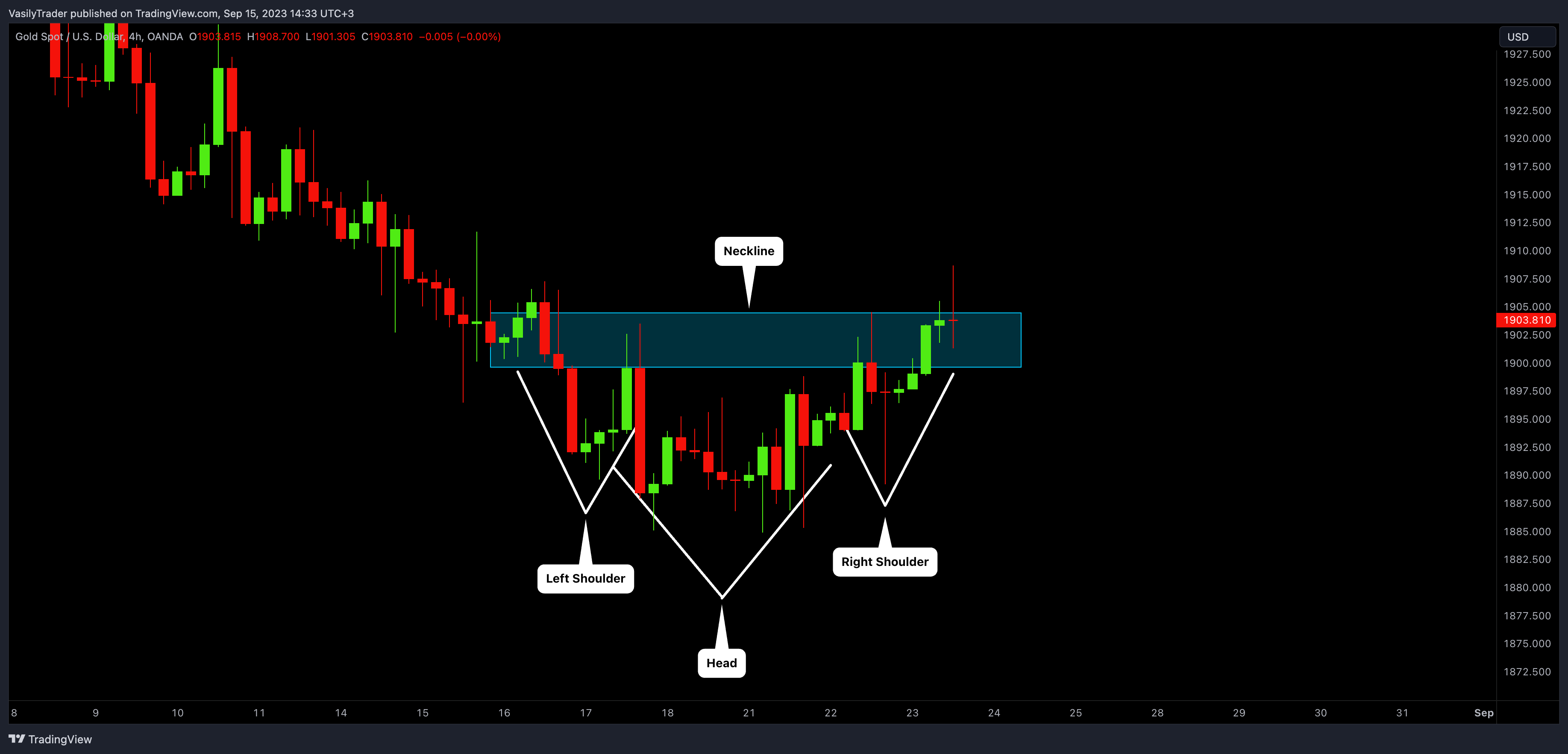 OANDA:XAUUSD Chart Image by VasilyTrader