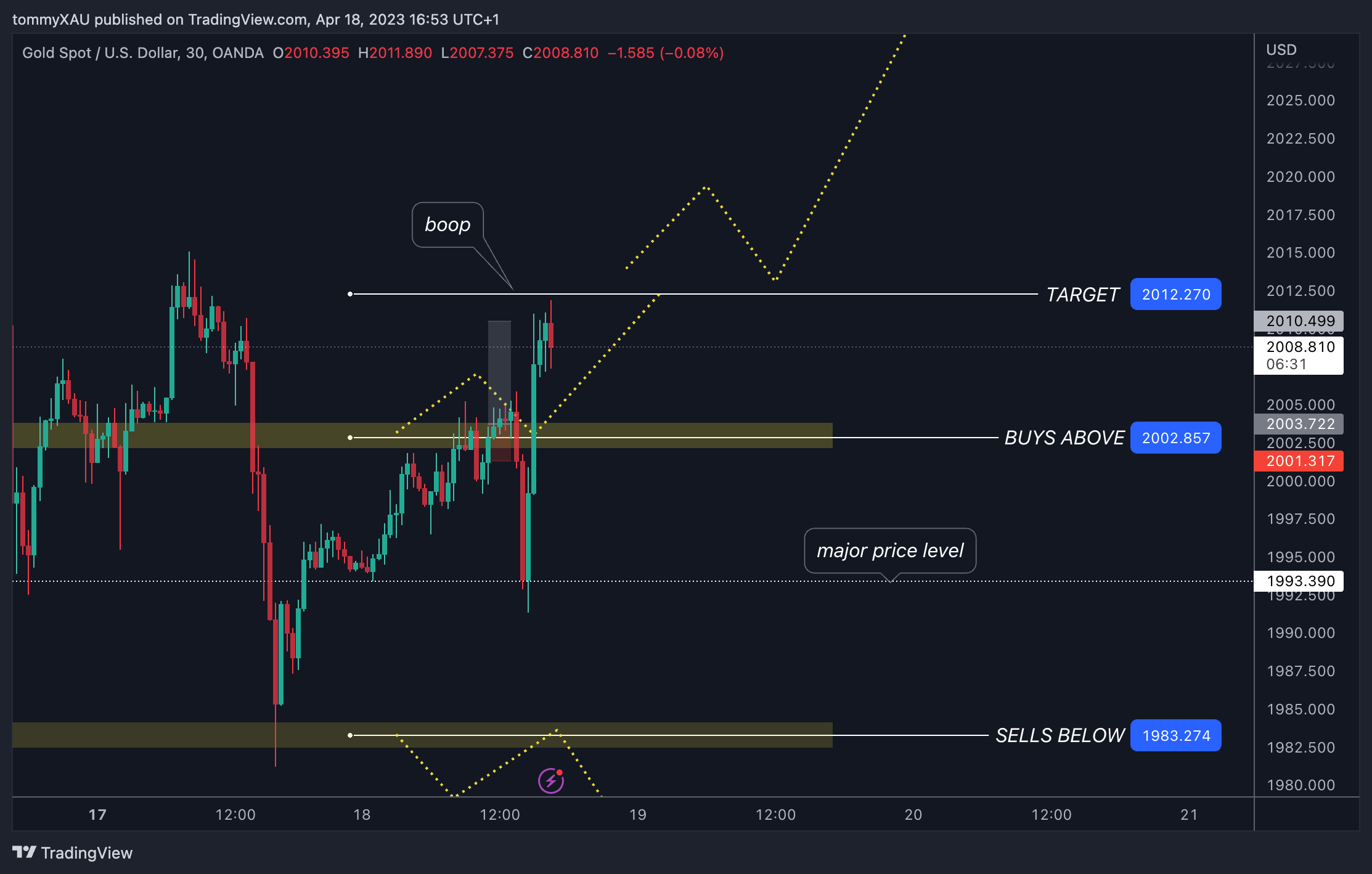 OANDA:XAUUSD Chart Image by tommyXAU