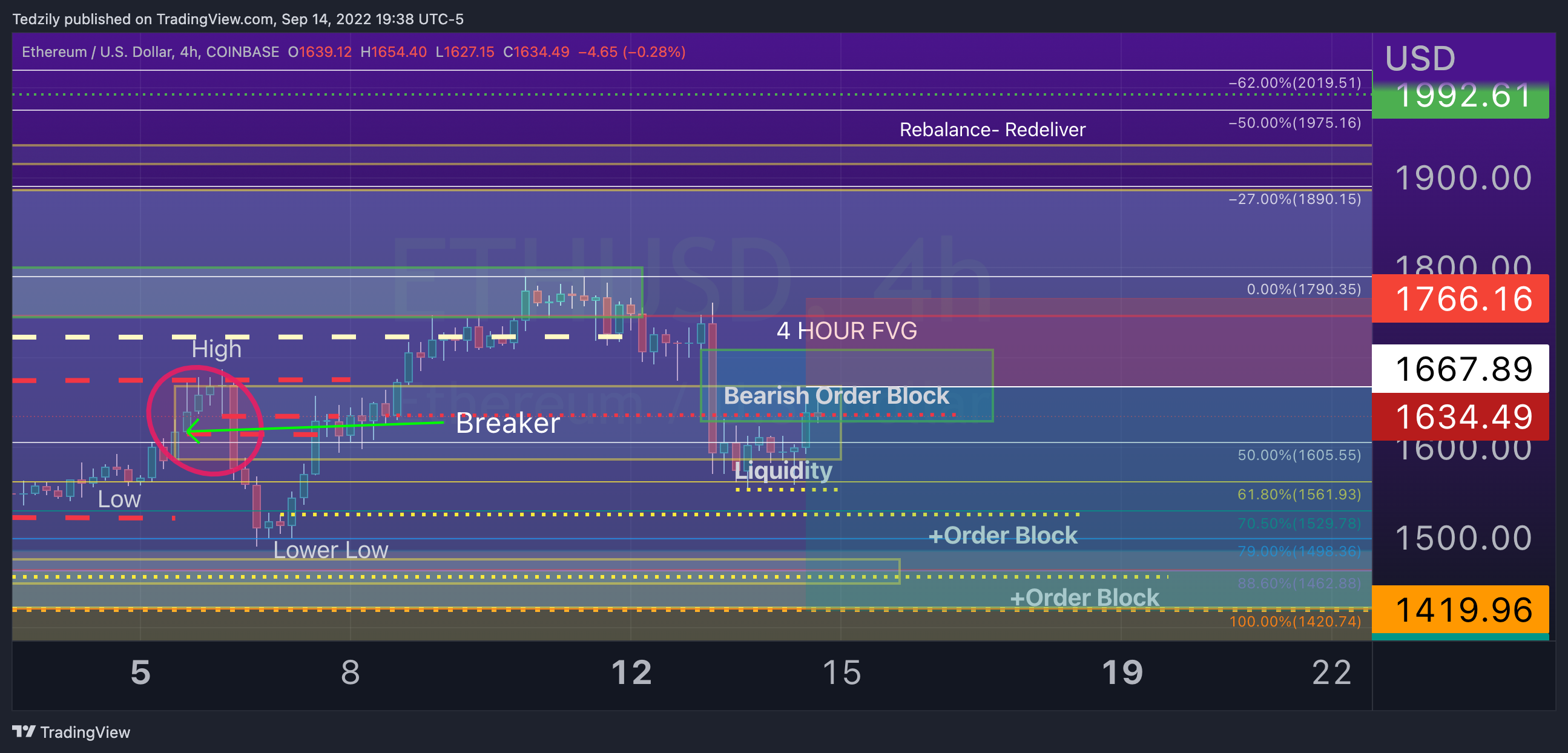 COINBASE:ETHUSD Chart Image by BodiesXWix