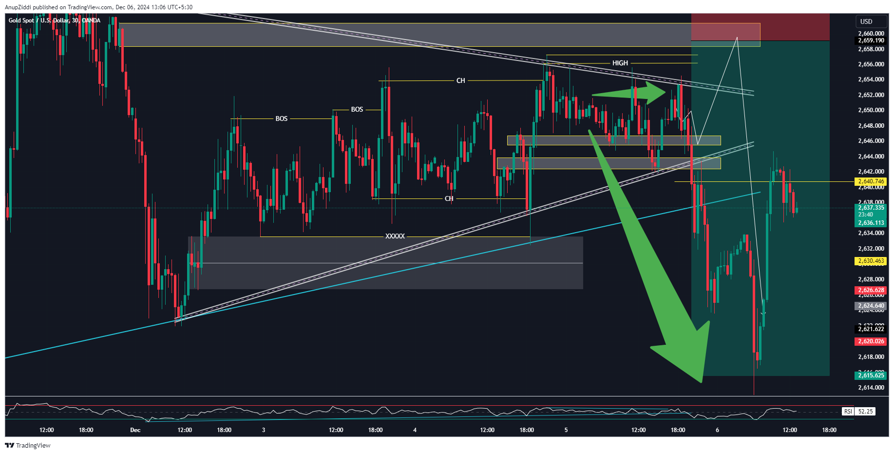 OANDA:XAUUSD Chart Image by AnupZiddi