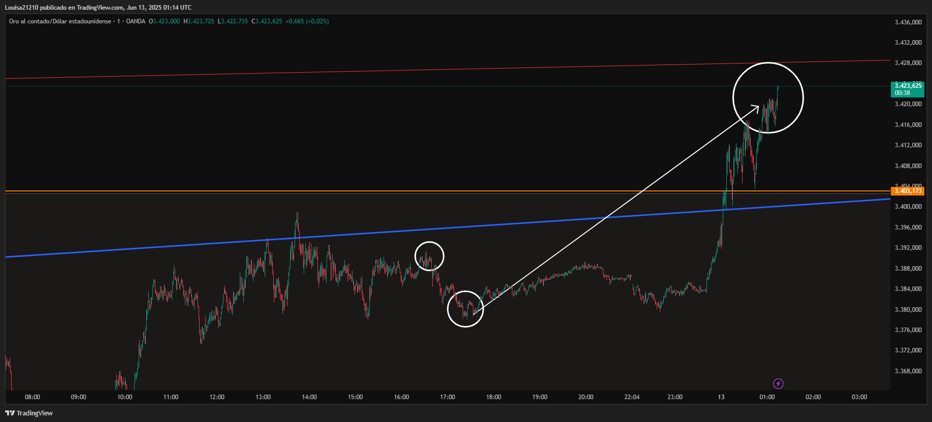OANDA:XAUUSD Chart Image by Louisa21210