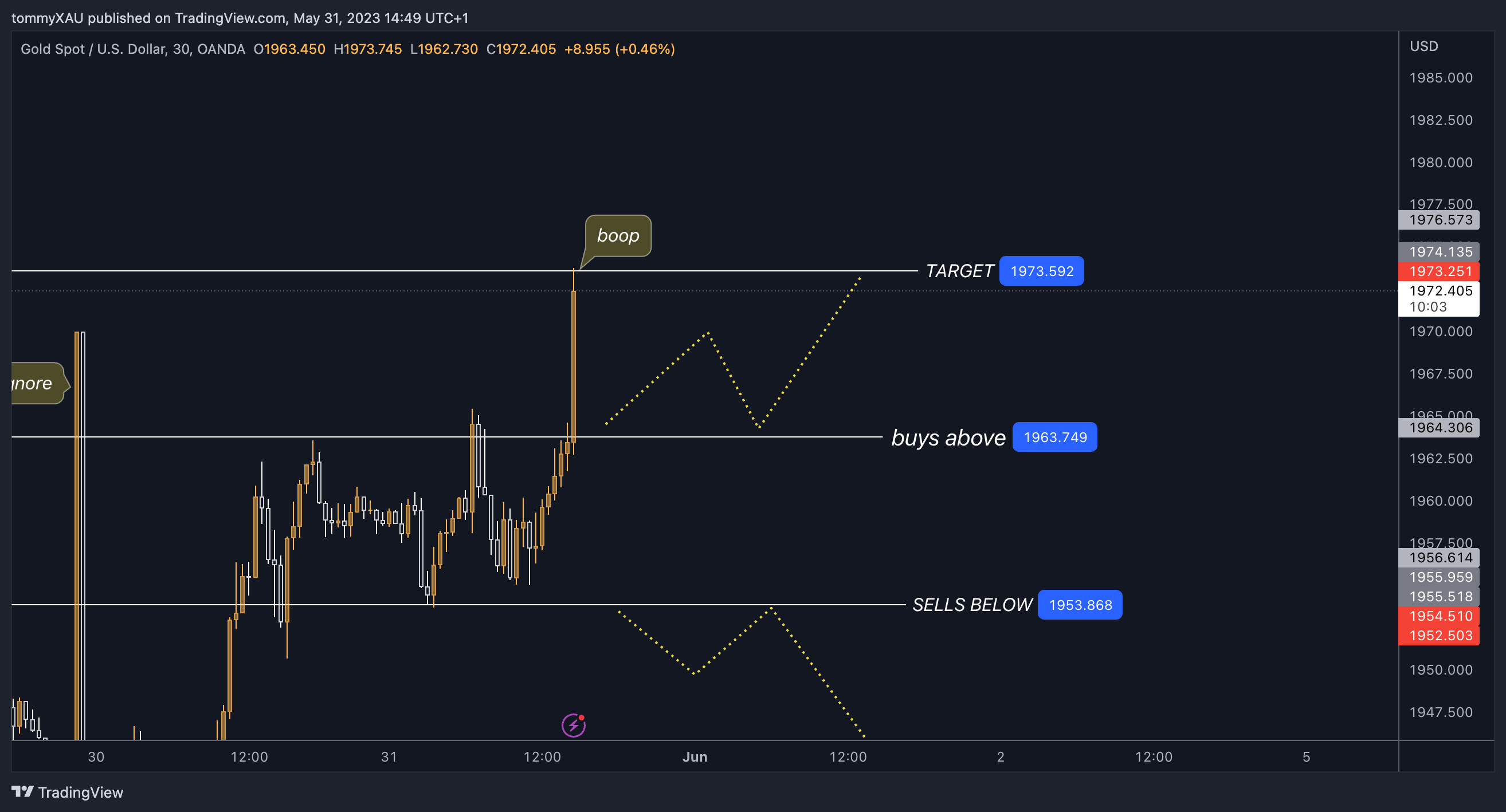OANDA:XAUUSD Chart Image by tommyXAU