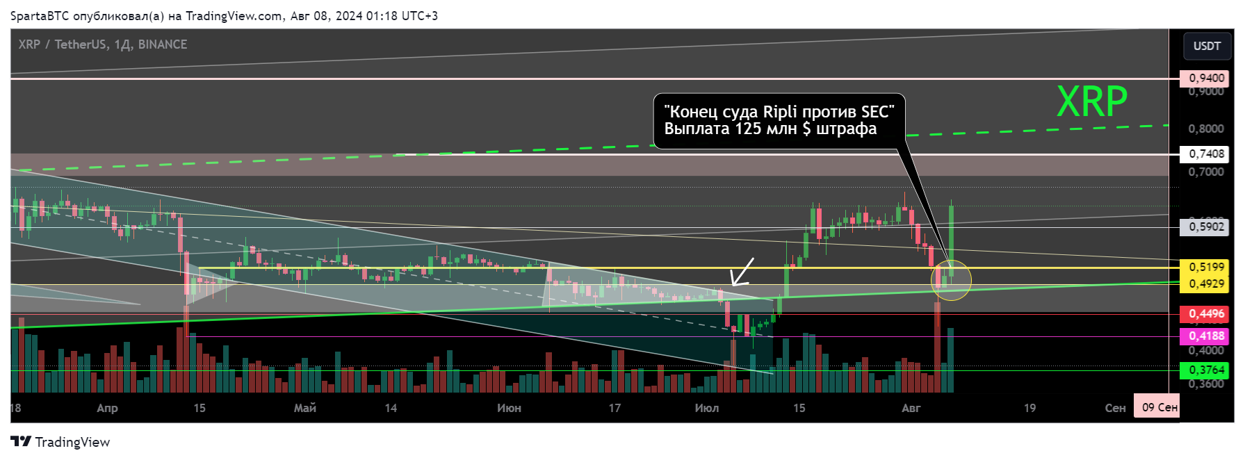BINANCE:XRPUSDT Chart Image by SpartaBTC
