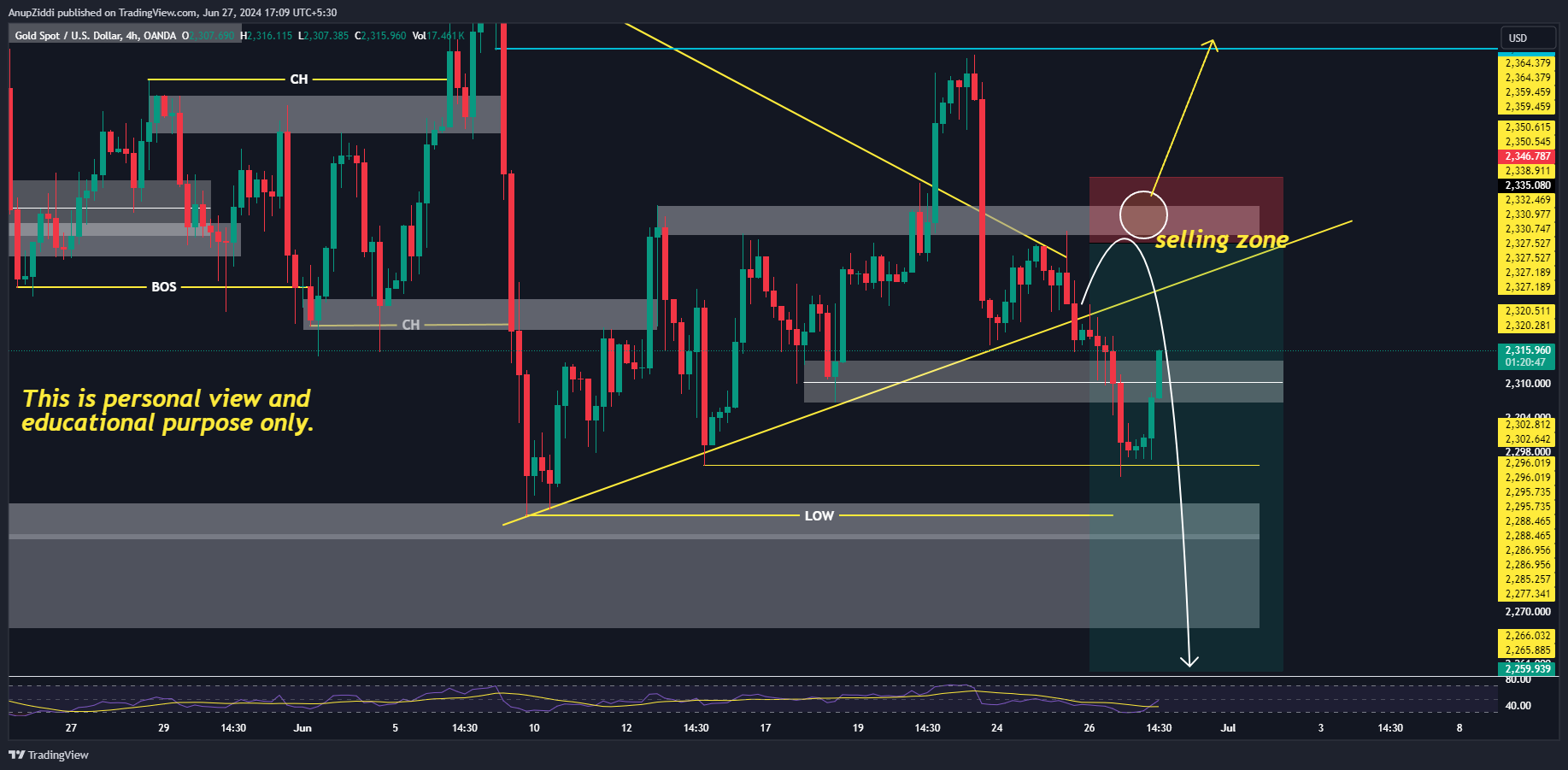 OANDA:XAUUSD Chart Image by AnupZiddi