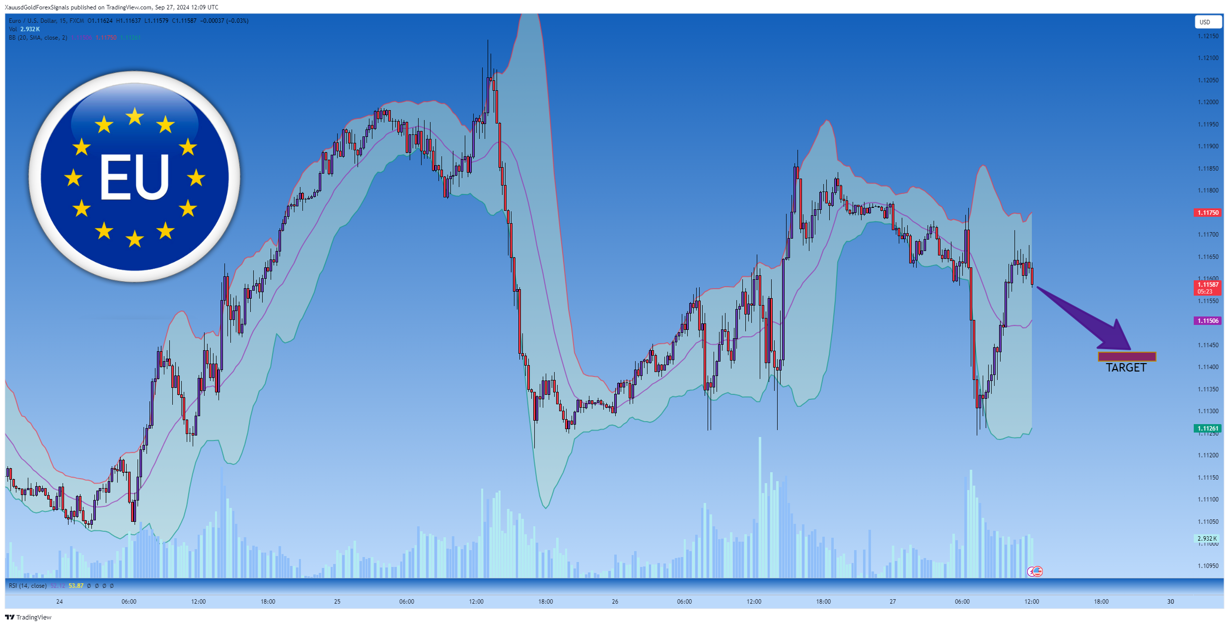 FX:EURUSD Chart Image by XauusdGoldForexSignals