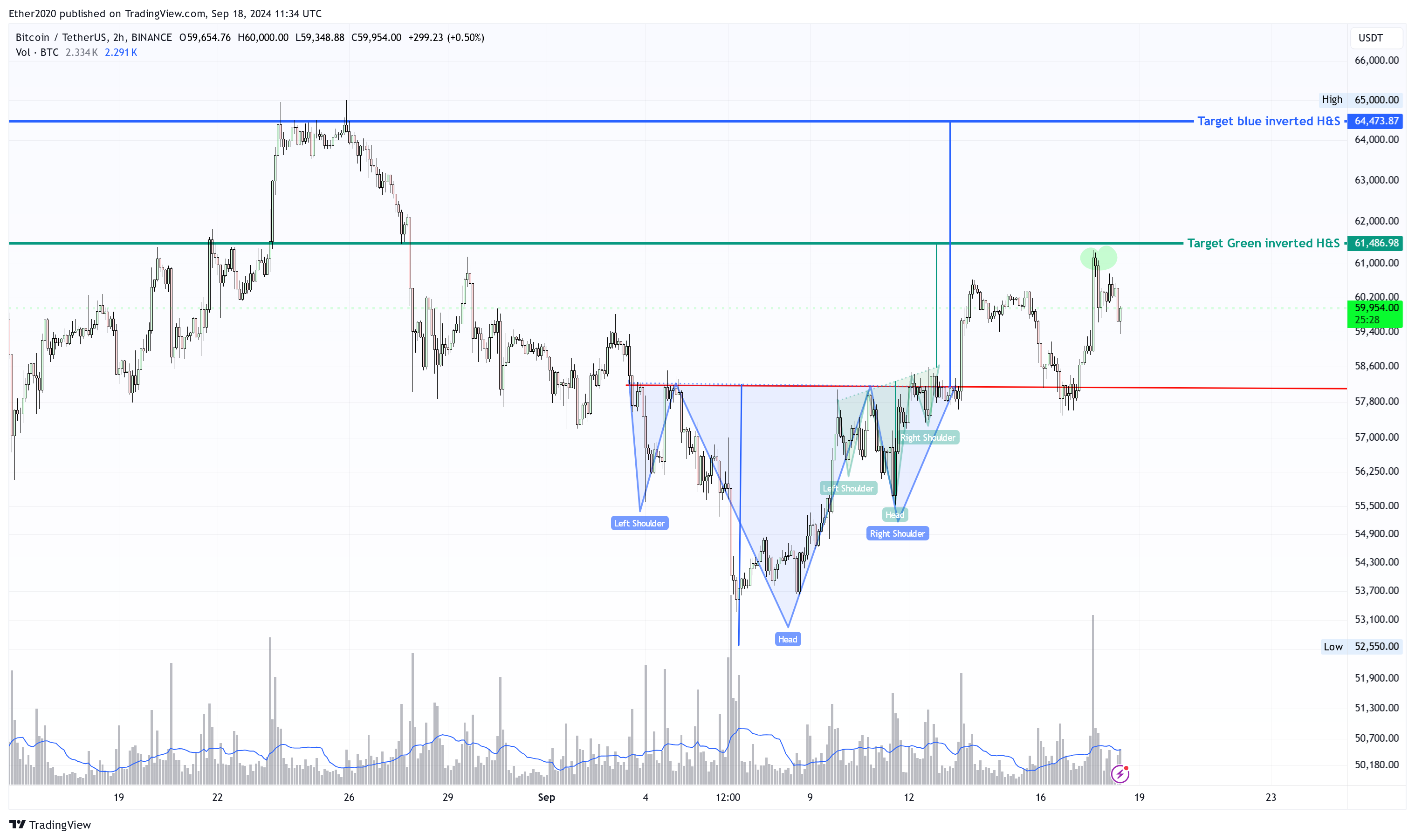 BINANCE:BTCUSDT Chart Image by PegasusTechCharts