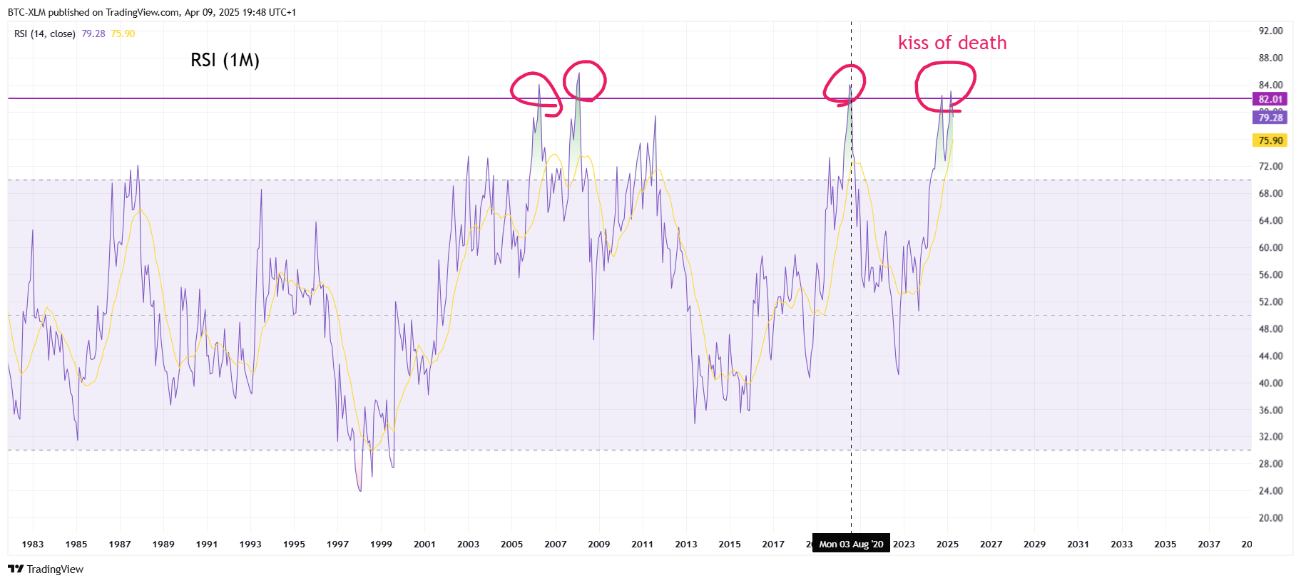 FX_IDC:XAUUSD Chart Image by BTC-XLM