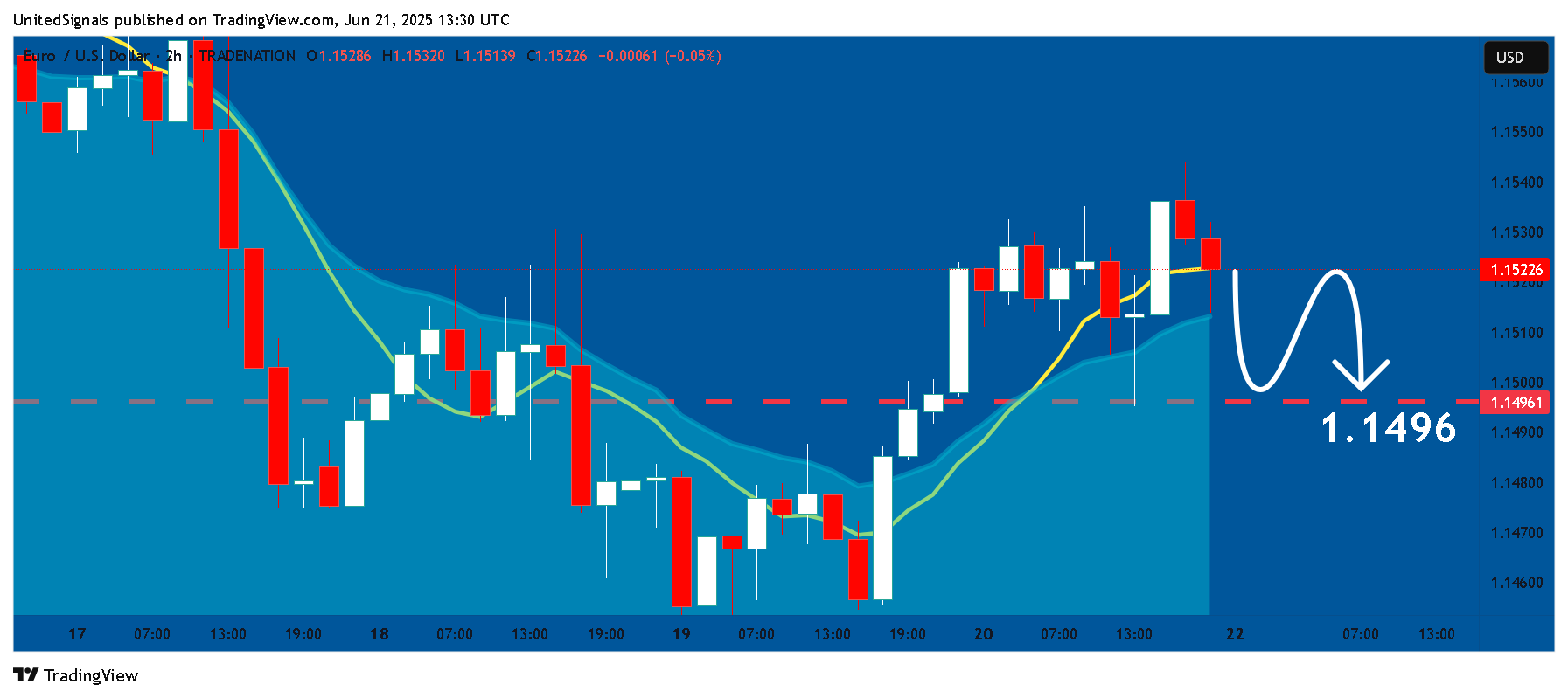 TRADENATION:EURUSD Chart Image by UnitedSignals