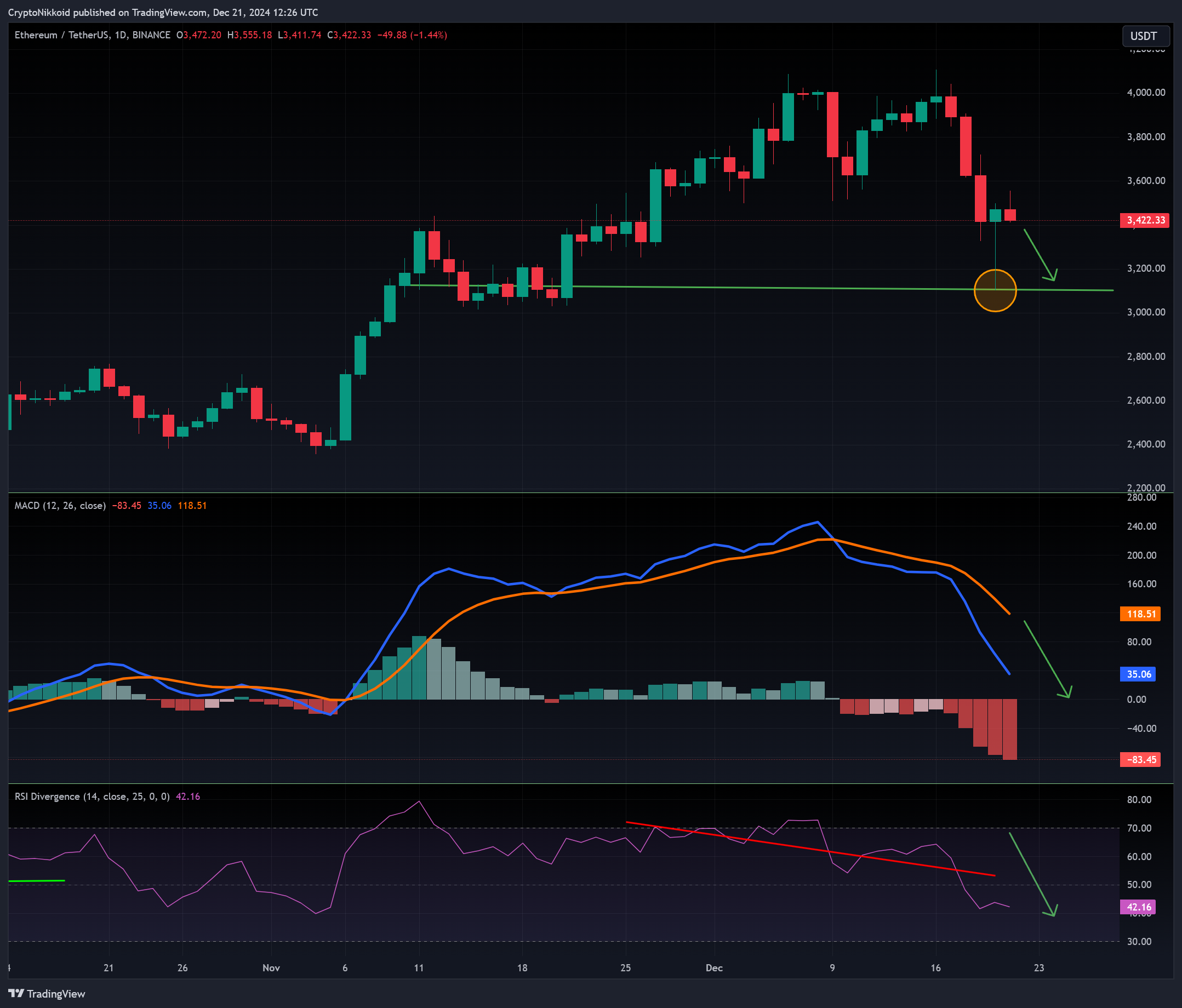 BINANCE:ETHUSDT Chart Image by CryptoNikkoid