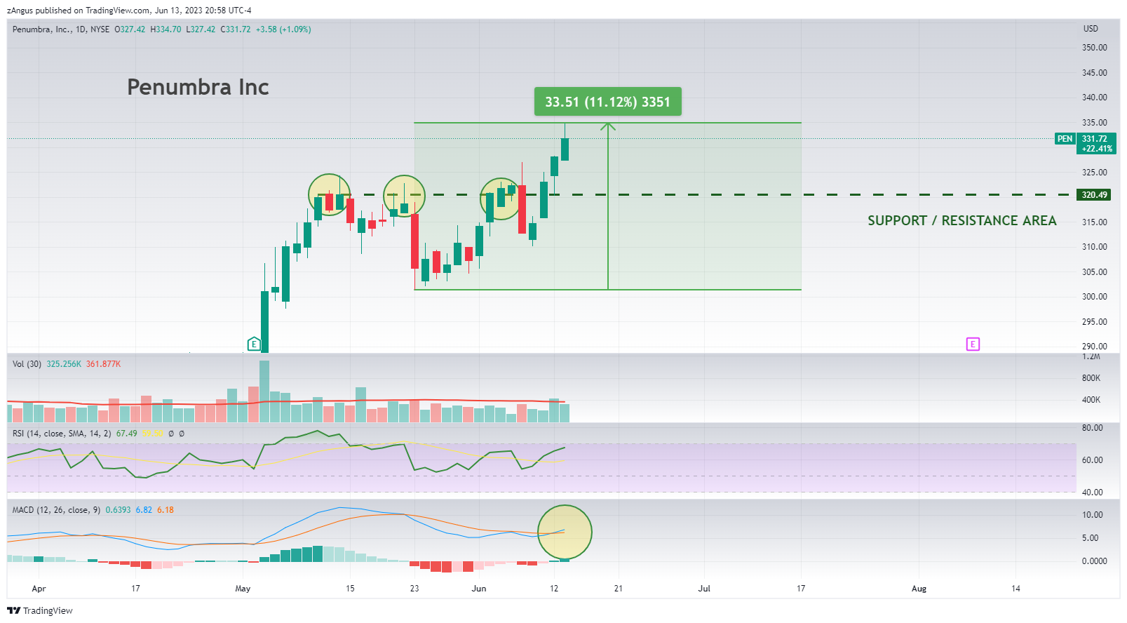 NYSE:PEN Chart Image by zAngus