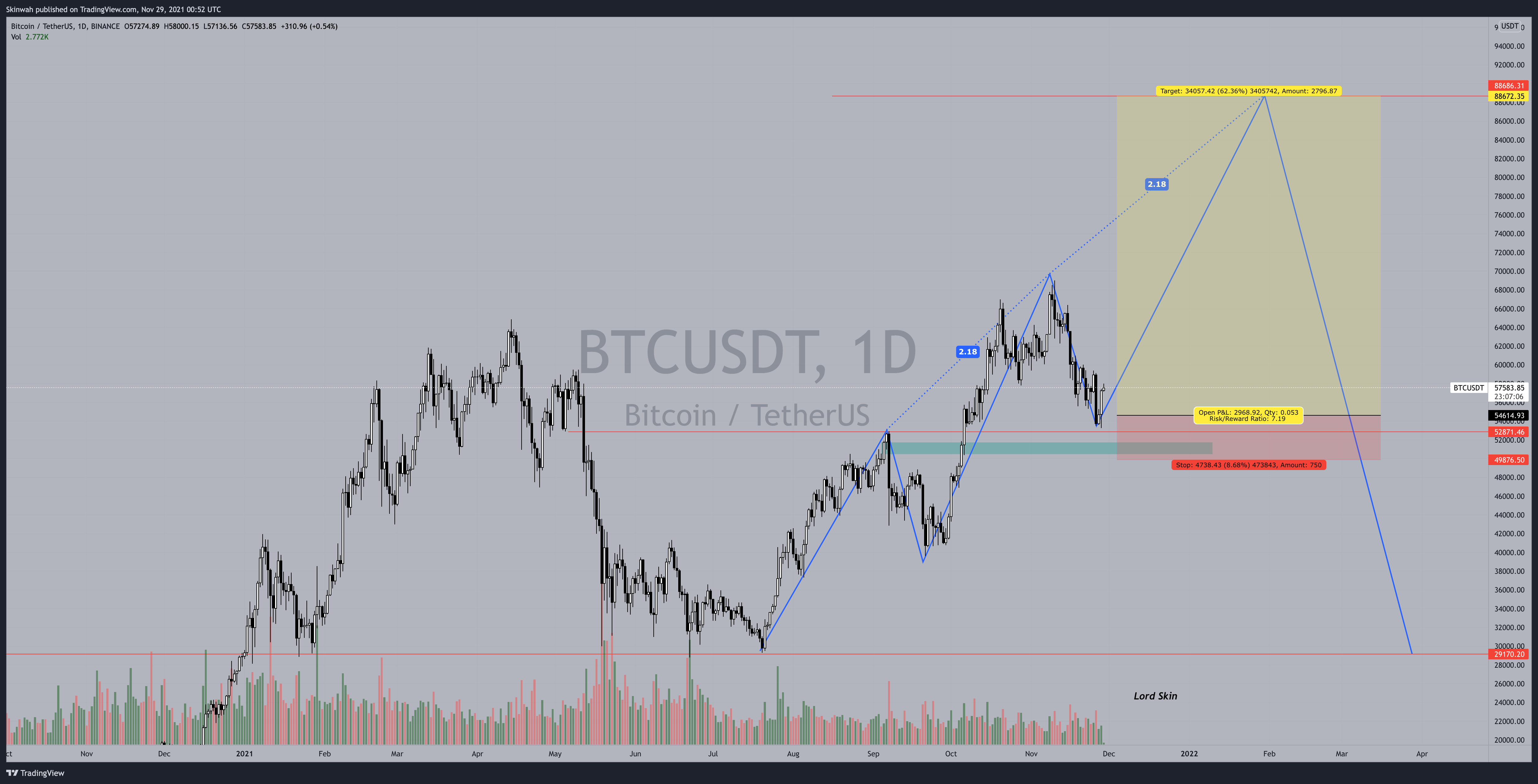 BINANCE:BTCUSDT Chart Image by Skinwah