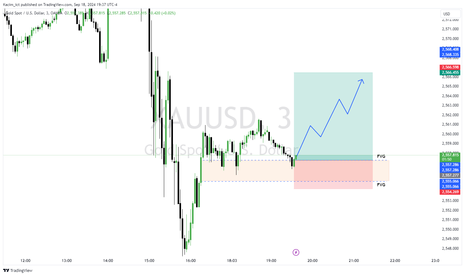 OANDA:XAUUSD Chart Image by Kacim_ict