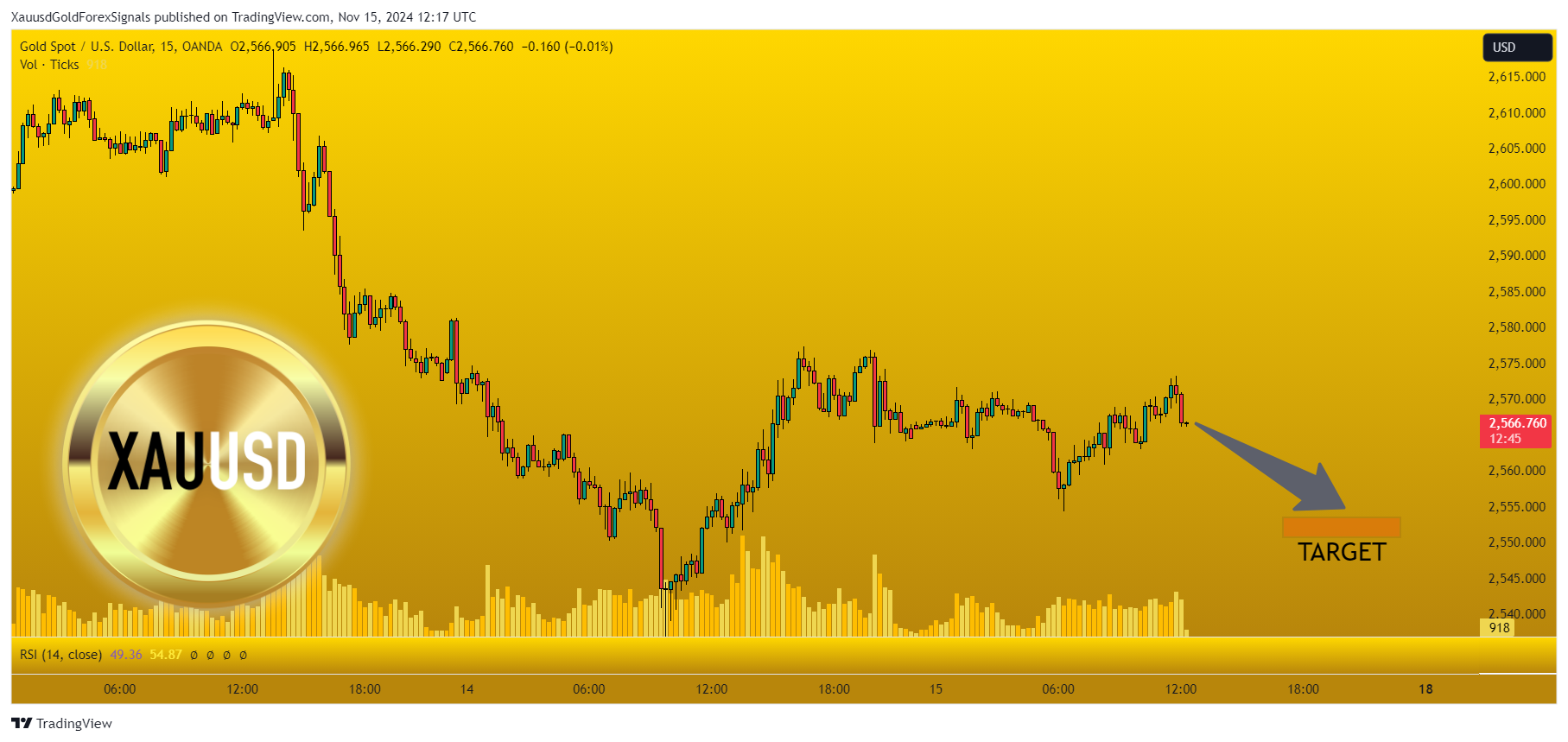 OANDA:XAUUSD Chart Image by XauusdGoldForexSignals