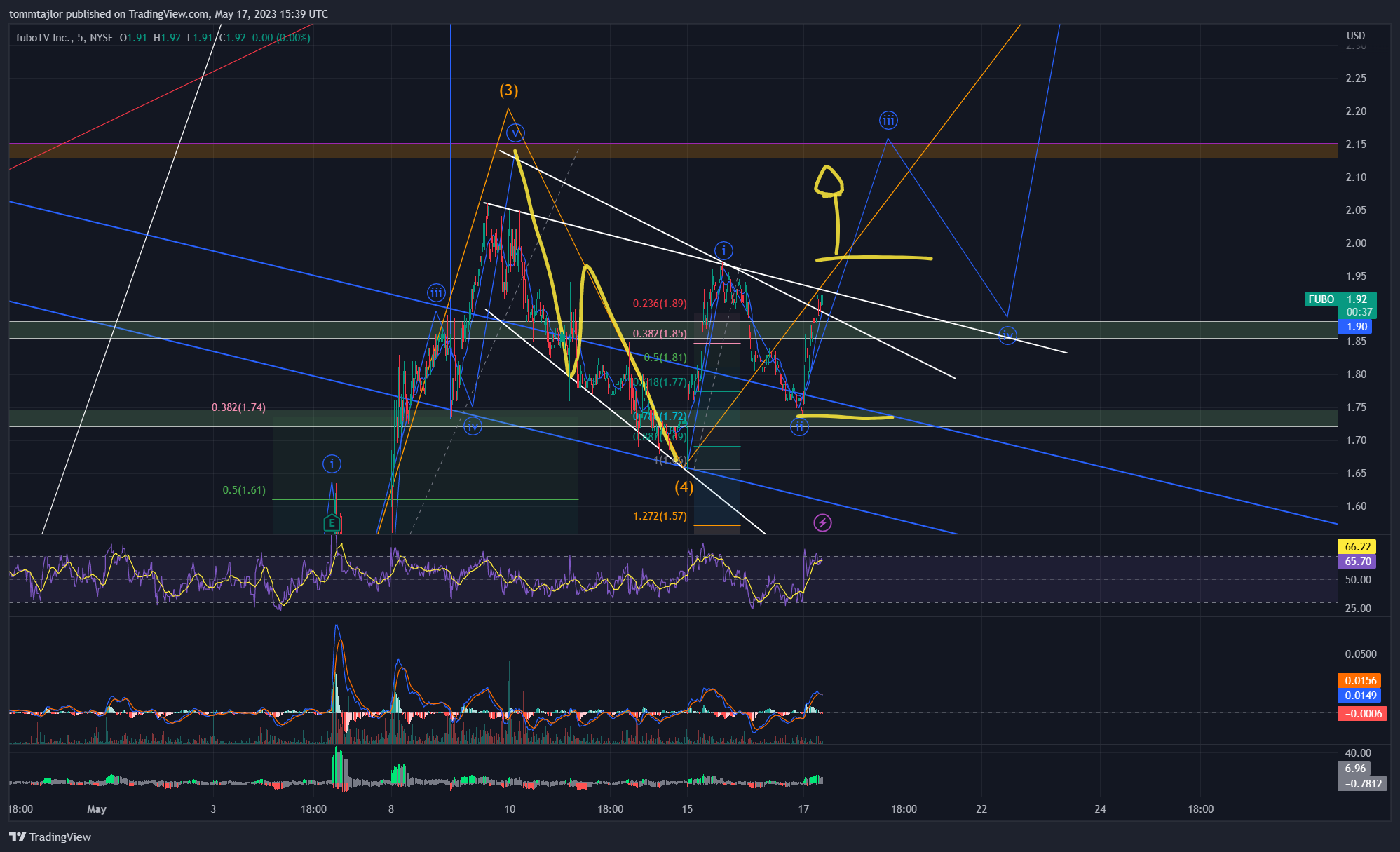 NYSE:FUBO Chart Image by tommtajlor
