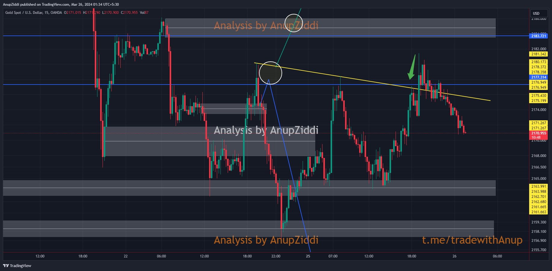 OANDA:XAUUSD Chart Image by AnupZiddi