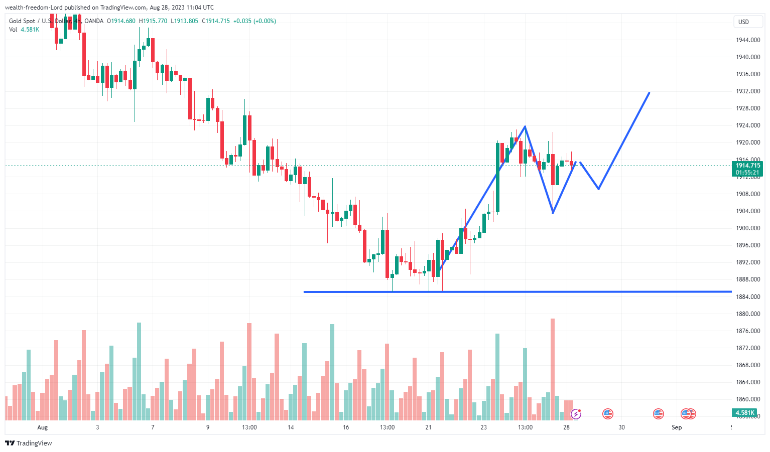 OANDA:XAUUSD Chart Image by wealth-freedom-Lord