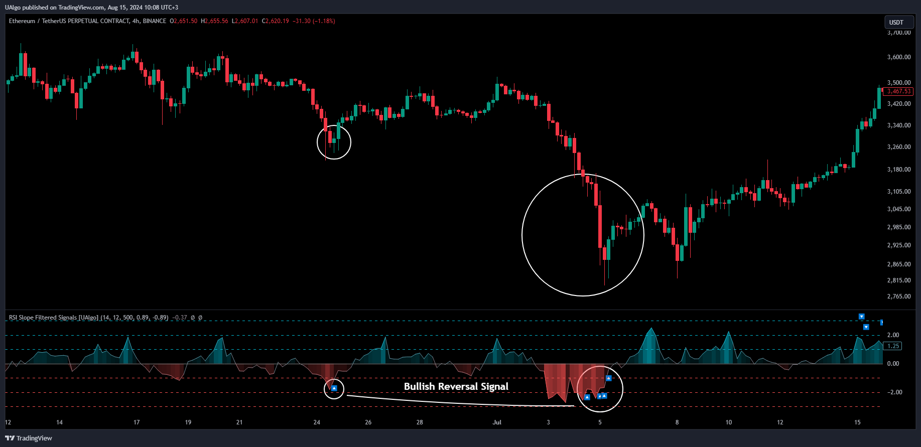 BINANCE:ETHUSDT.P Chart Image by UAlgo