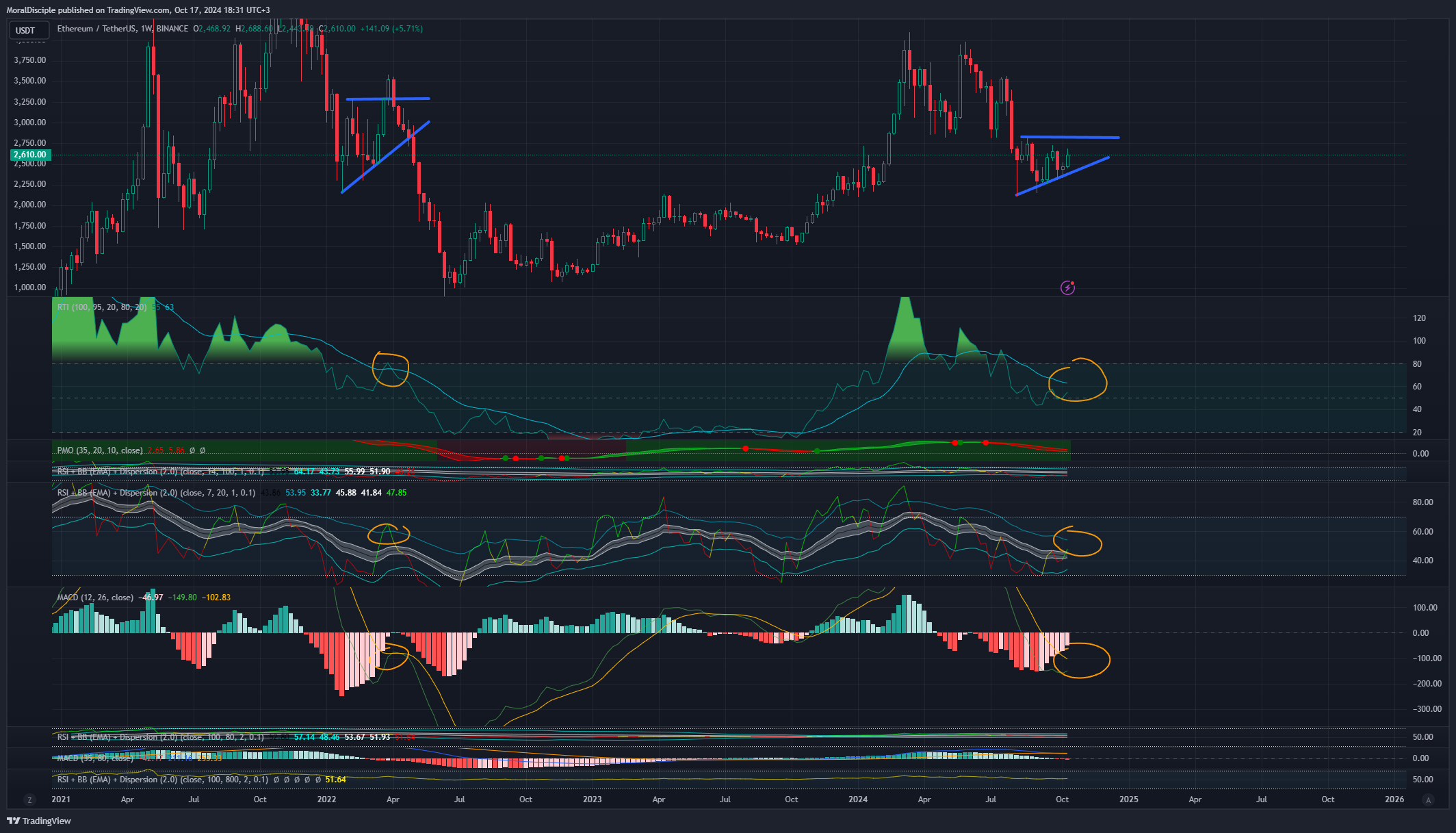BINANCE:ETHUSDT Chart Image by MoralDisciple