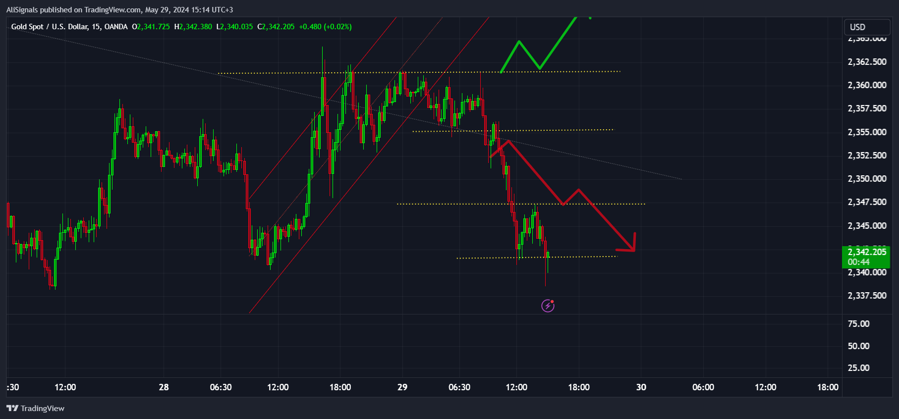 OANDA:XAUUSD Chart Image by AliSignals