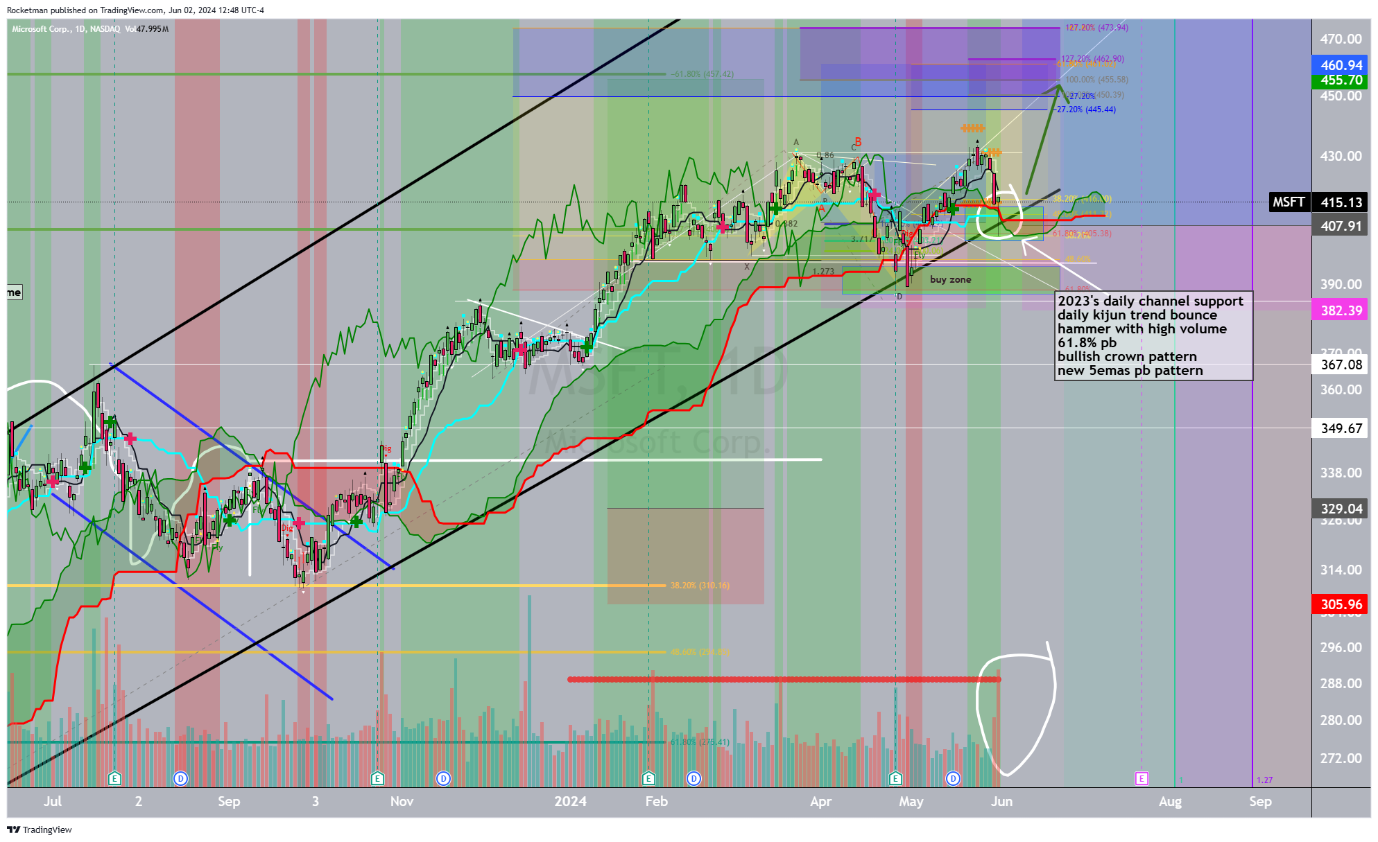 BATS:MSFT Chart Image by Rocketman