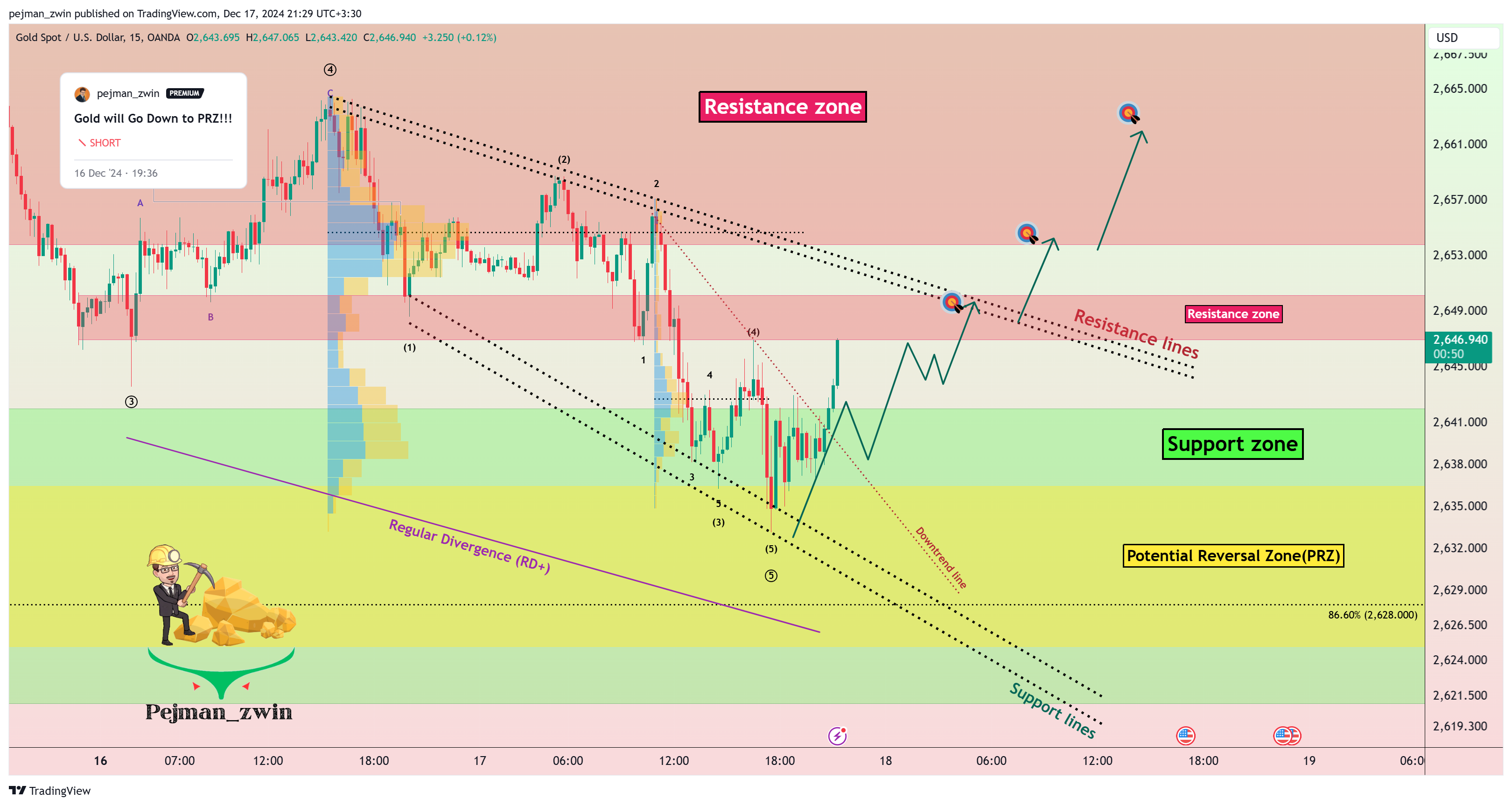 OANDA:XAUUSD Chart Image by pejman_zwin