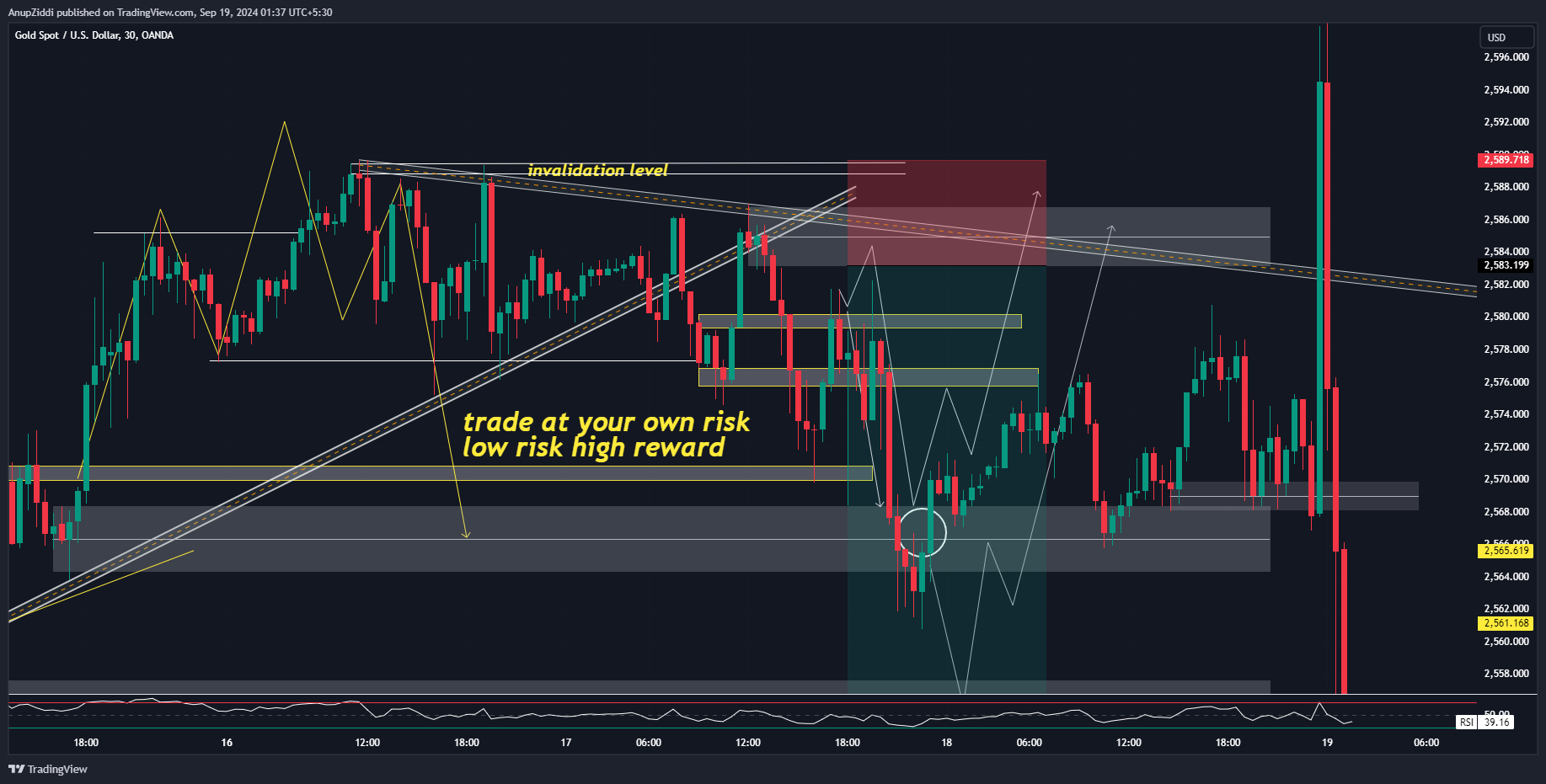 OANDA:XAUUSD Chart Image by AnupZiddi