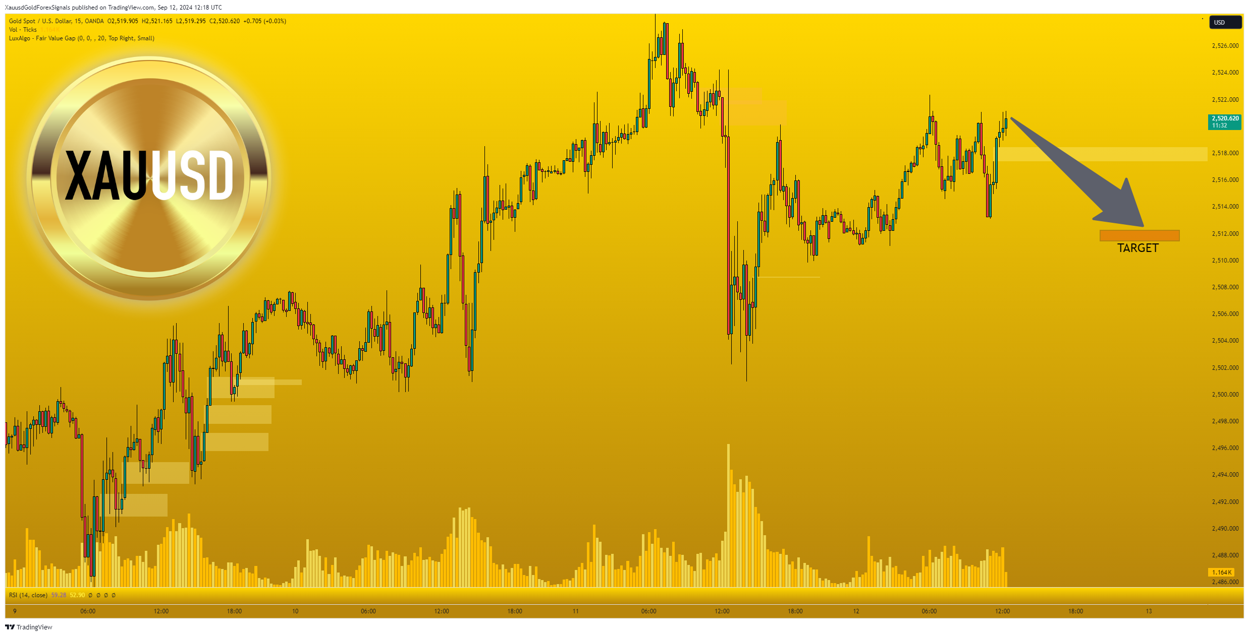 OANDA:XAUUSD Chart Image by XauusdGoldForexSignals