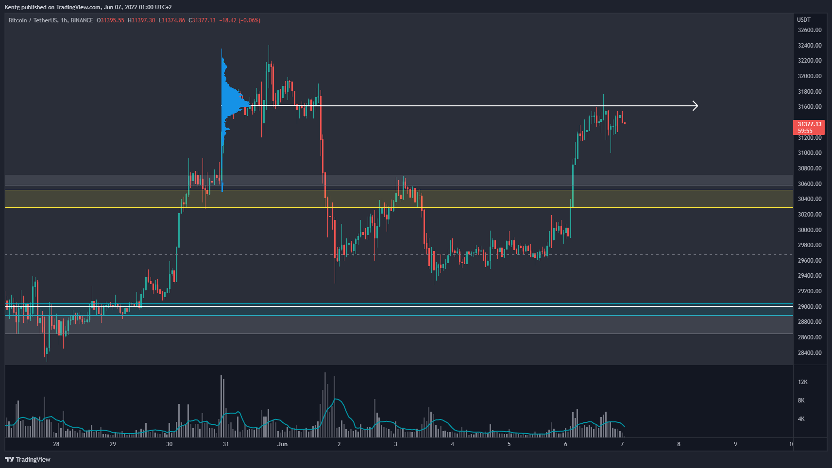 BINANCE:BTCUSDT Chart Image by Kentg
