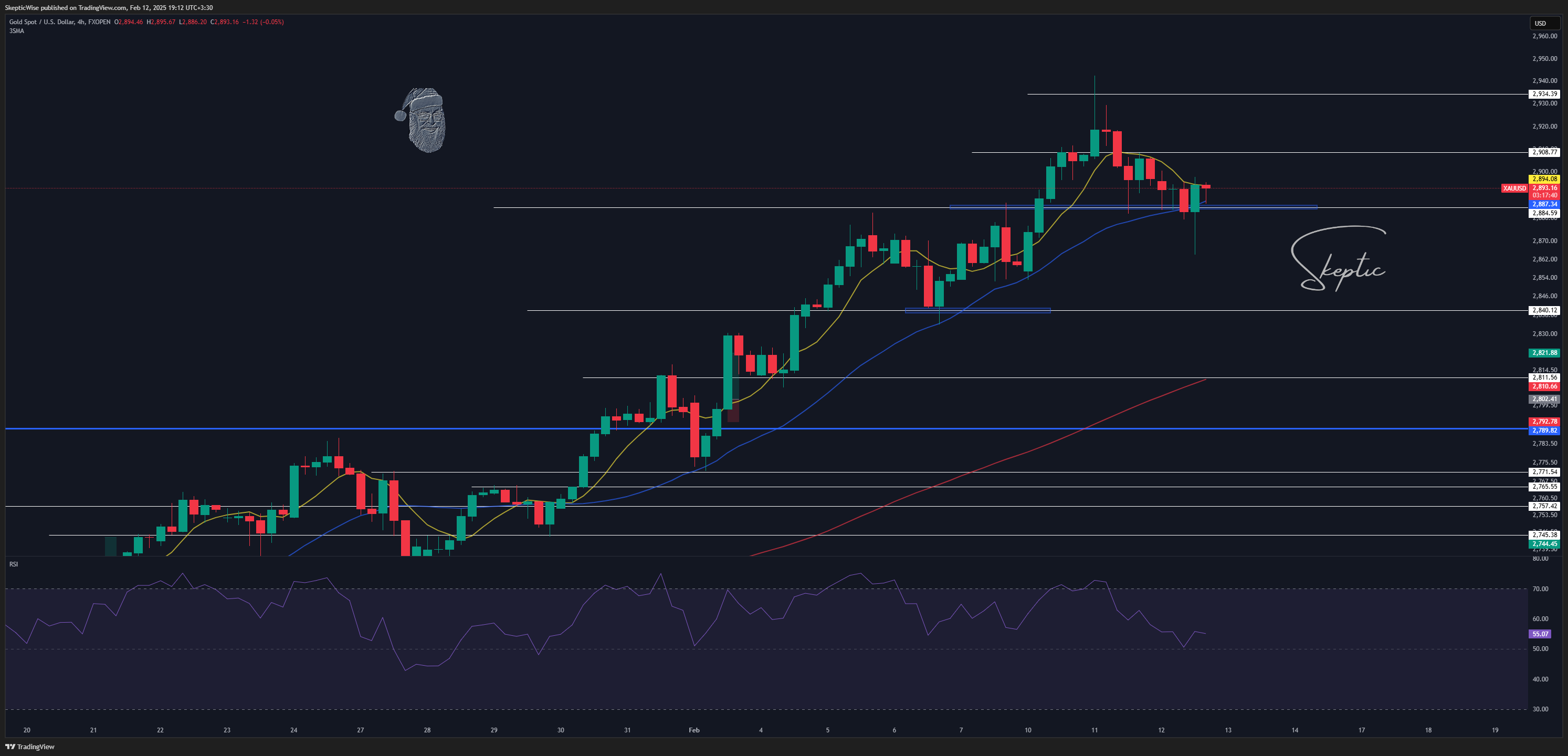 FXOPEN:XAUUSD Chart Image by SkepticLab