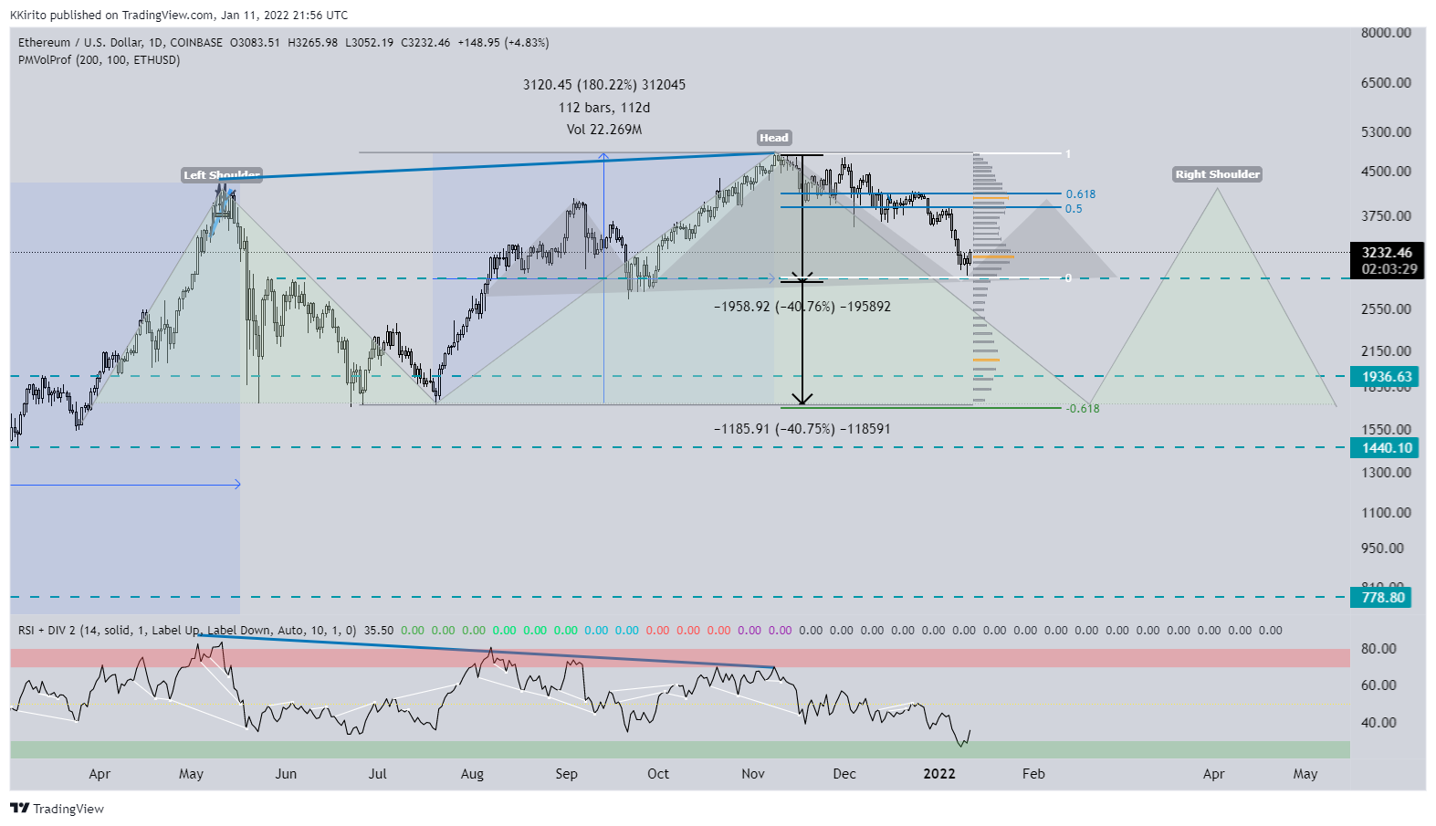 COINBASE:ETHUSD Chart Image by KKirito