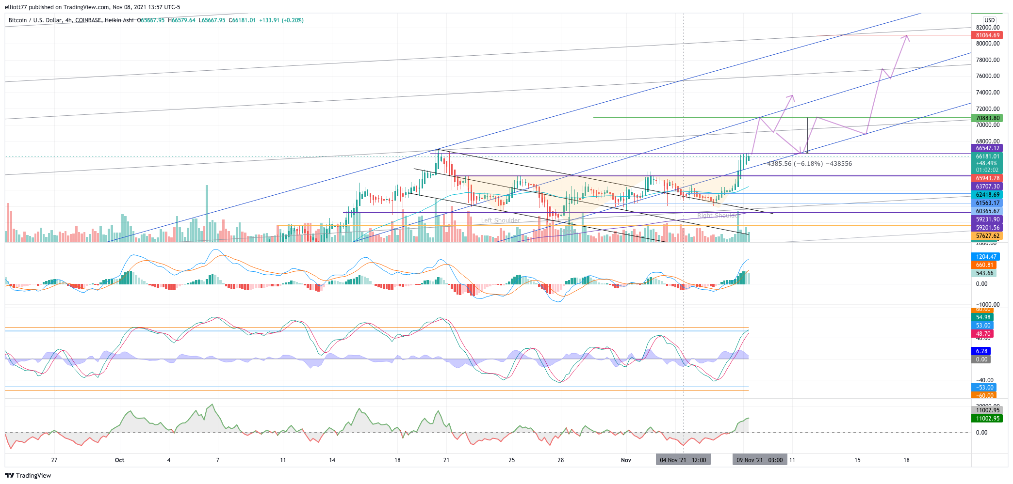 COINBASE:BTCUSD Chart Image by elliott77